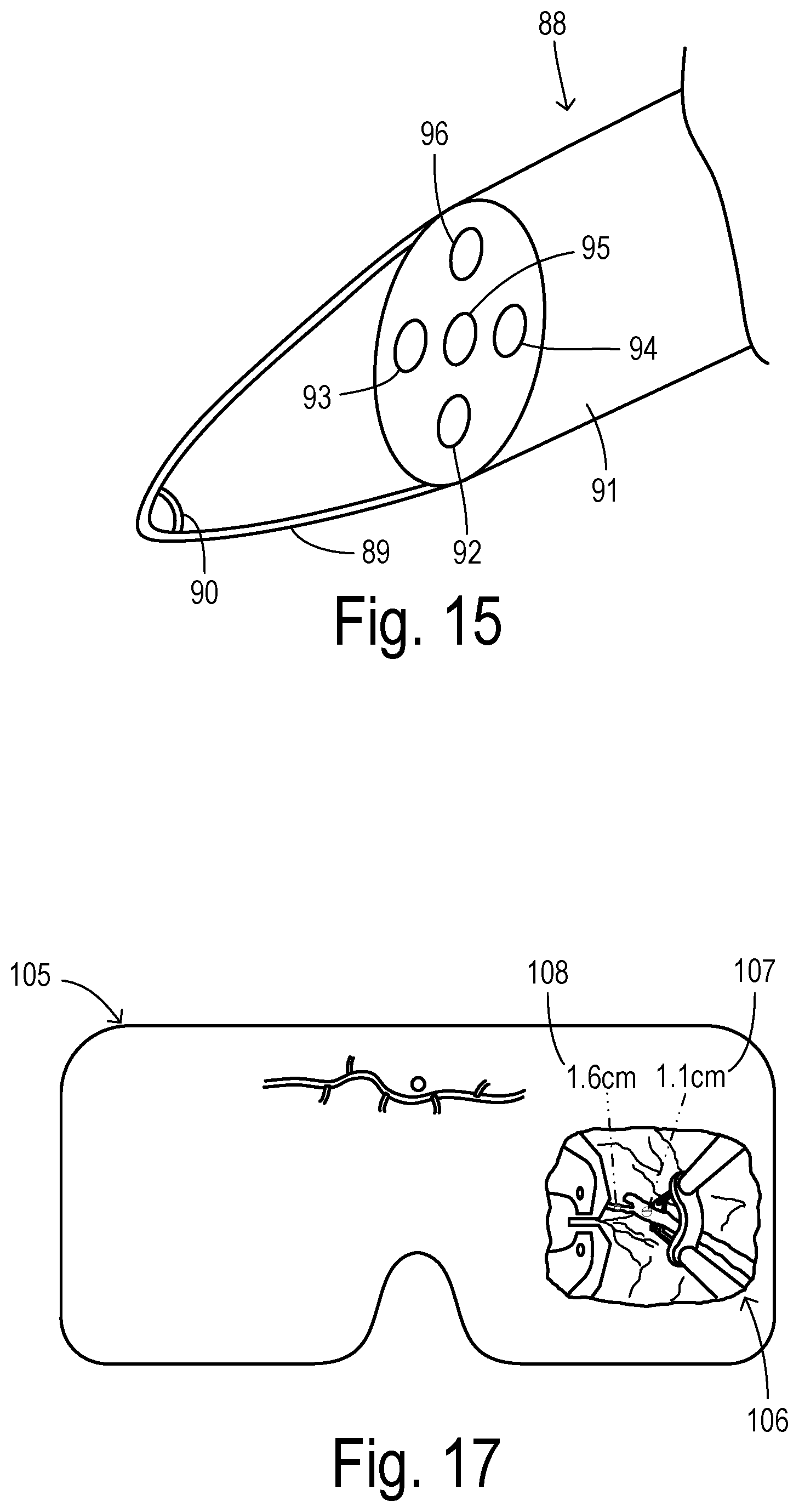 Patent US12564471 Figure 7 – Augmented-reality endoscopic vessel harvesting