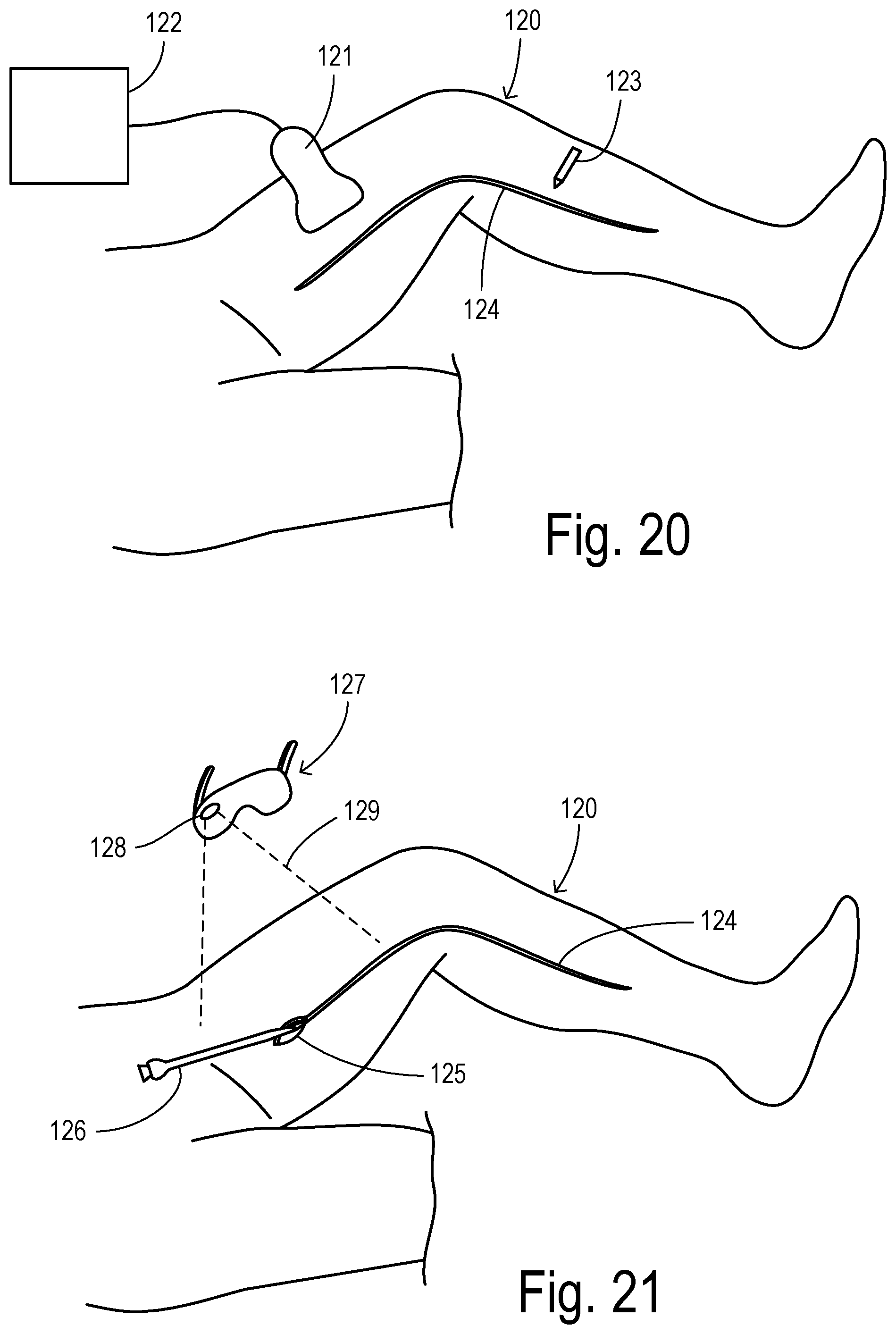 Patent US12564471 Figure 9 – Augmented-reality endoscopic vessel harvesting