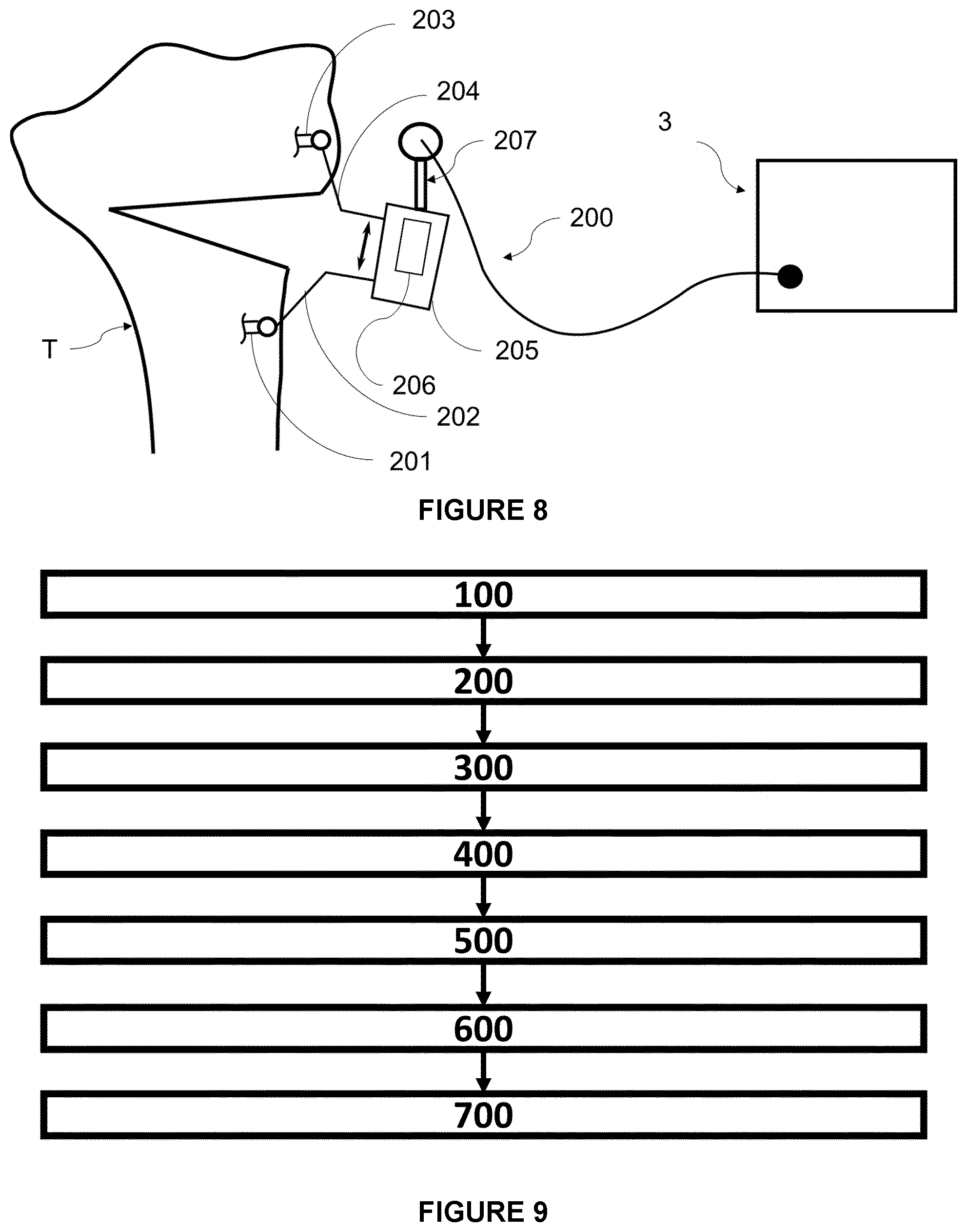 Patent US12564472 Figure 7 – System for guiding an osteotomy procedure