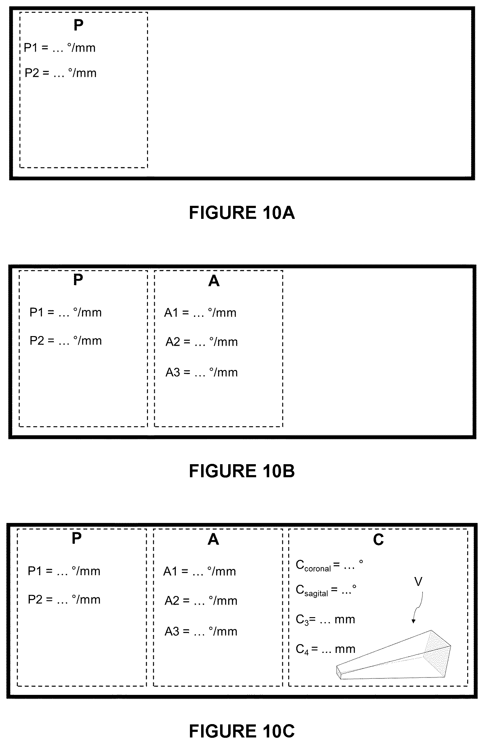 Patent US12564472 Figure 8 – System for guiding an osteotomy procedure