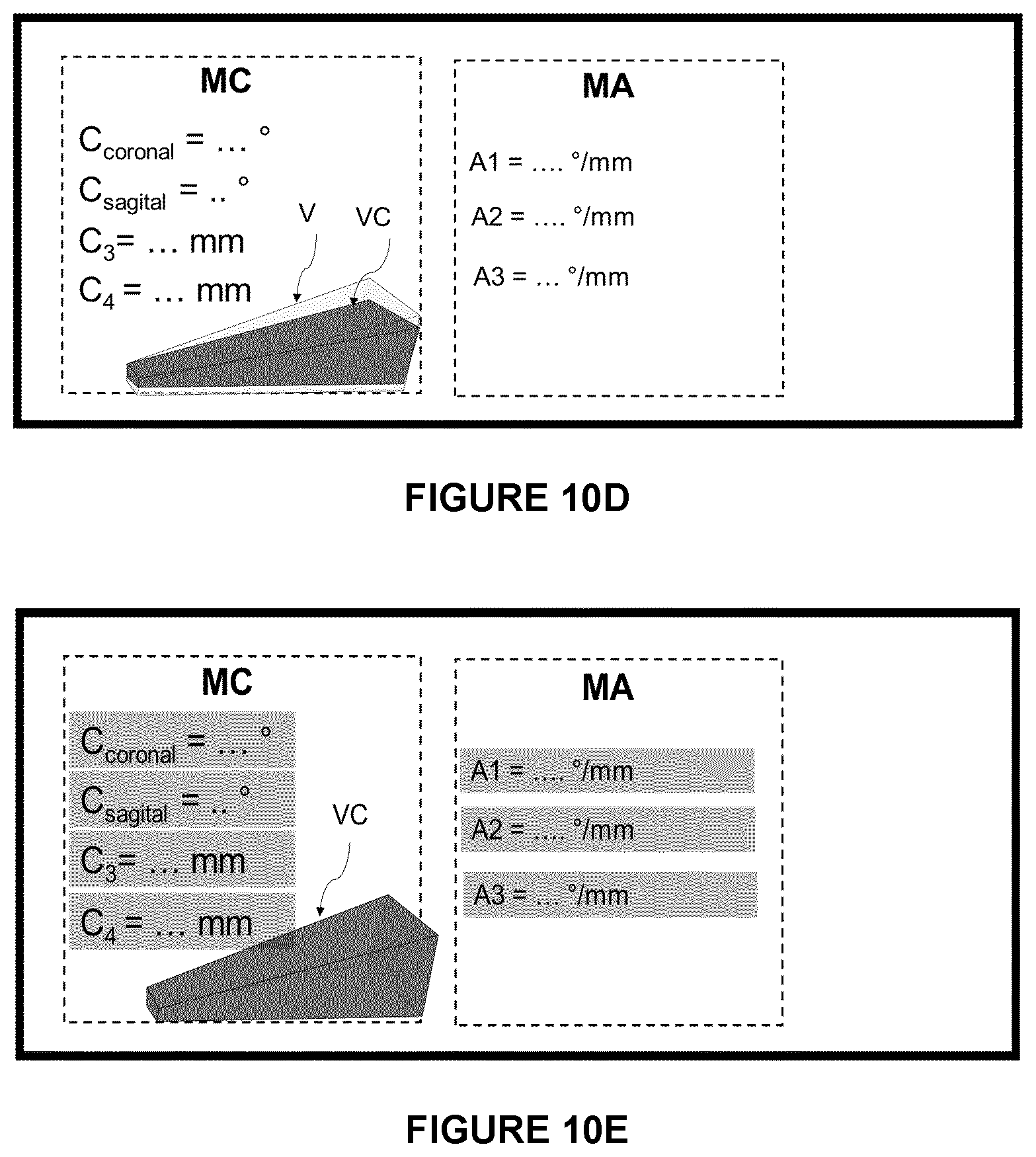 Patent US12564472 Figure 9 – System for guiding an osteotomy procedure