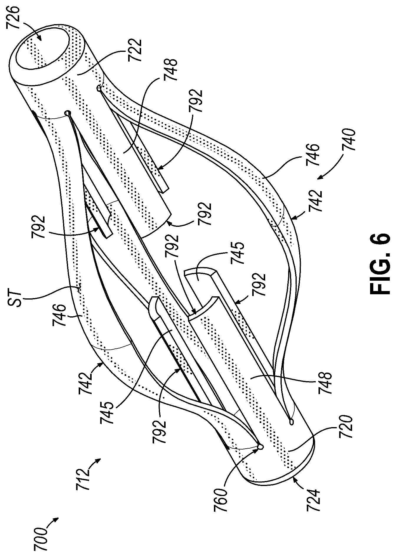 Patent US12564473 Figure 6 – Biopsy site marker having movable portions
