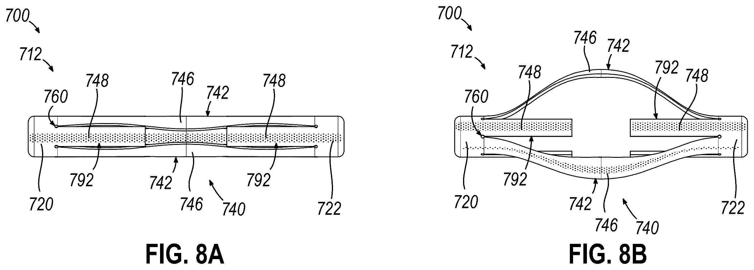 Patent US12564473 Figure 8 – Biopsy site marker having movable portions
