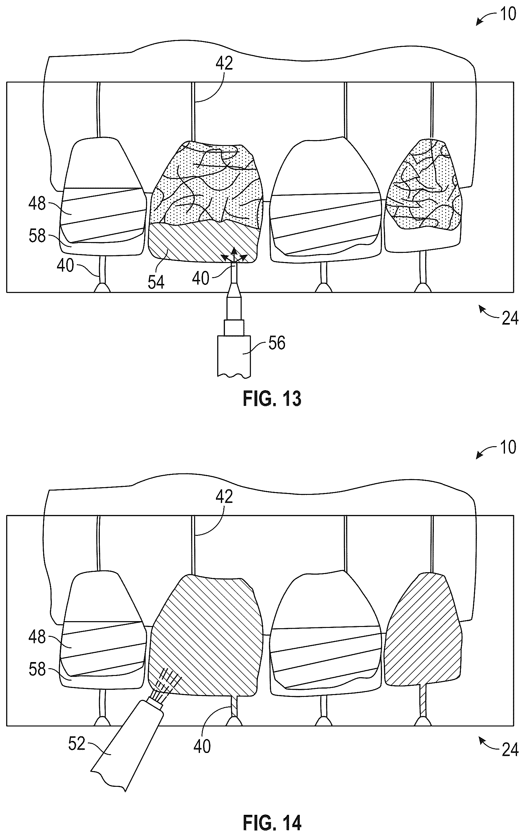 Patent US12564476 Figure 6 – Device and kit for injection bonding multi-tooth dental restoration in a single treatment