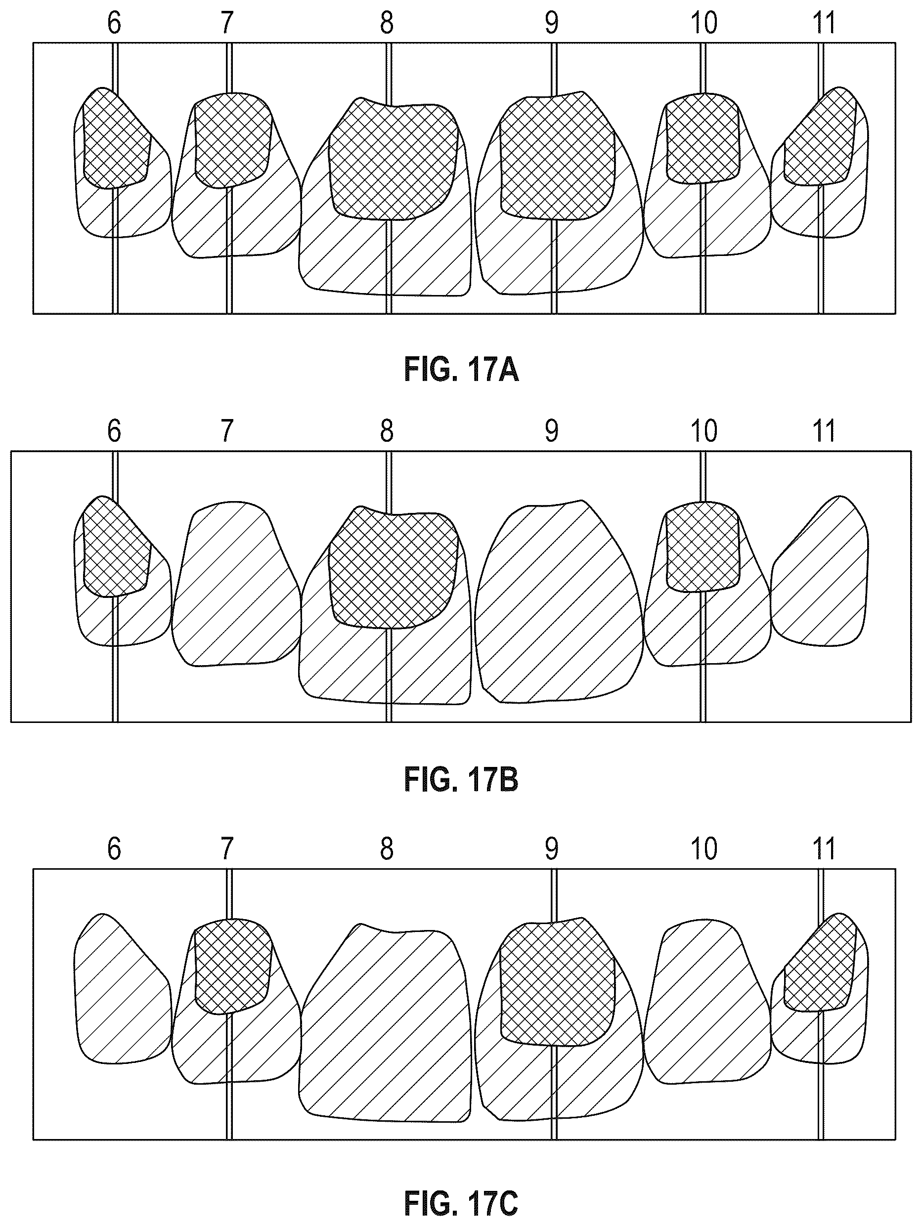 Patent US12564476 Figure 8 – Device and kit for injection bonding multi-tooth dental restoration in a single treatment