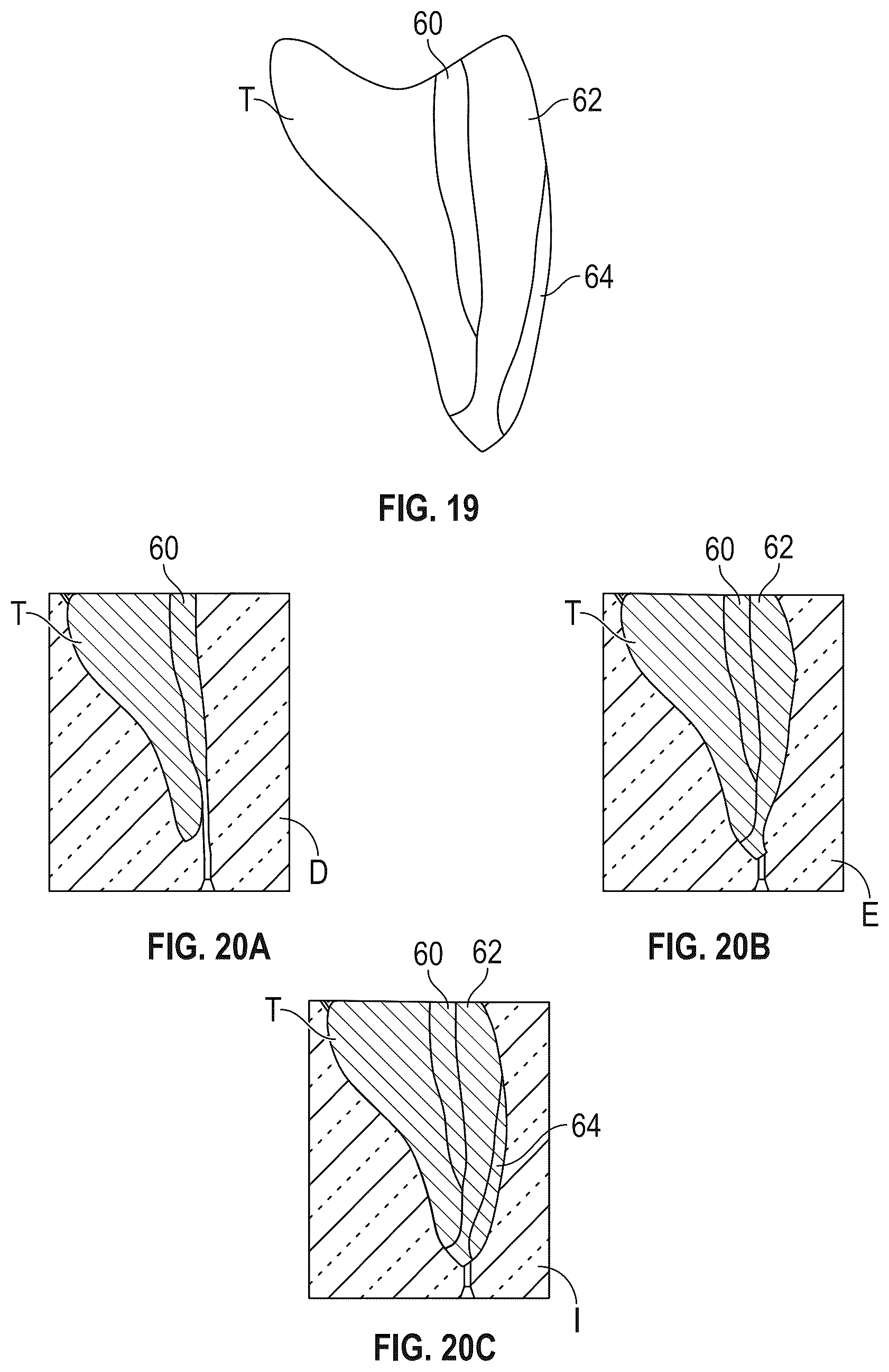 Patent US12564476 Figure 10 – Device and kit for injection bonding multi-tooth dental restoration in a single treatment