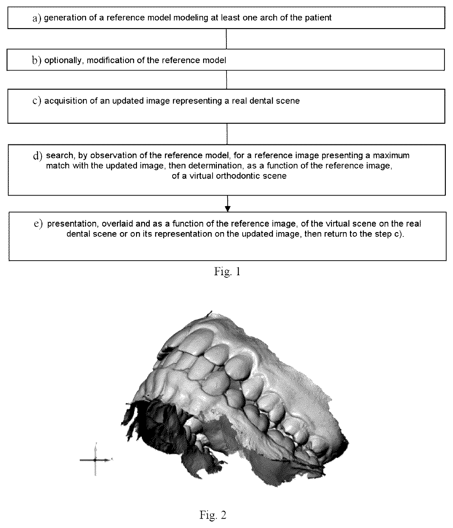 Patent US12564478 Figure 1 – Method for analysing a dental situation