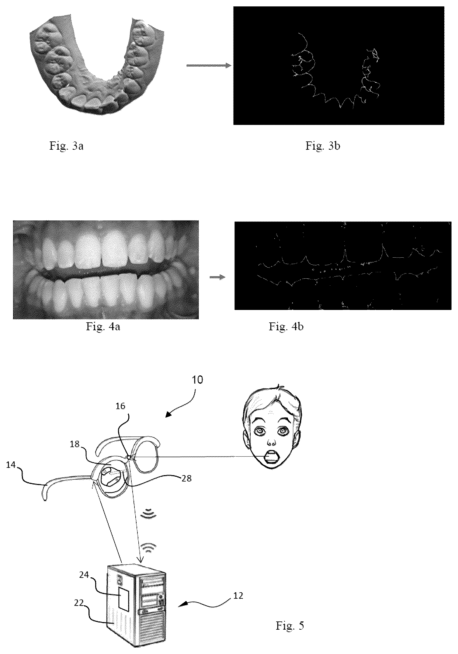 Patent US12564478 Figure 2 – Method for analysing a dental situation