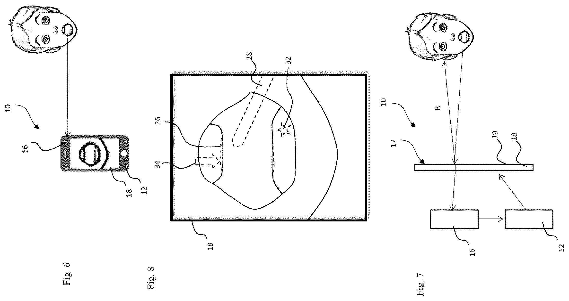 Patent US12564478 Figure 3 – Method for analysing a dental situation