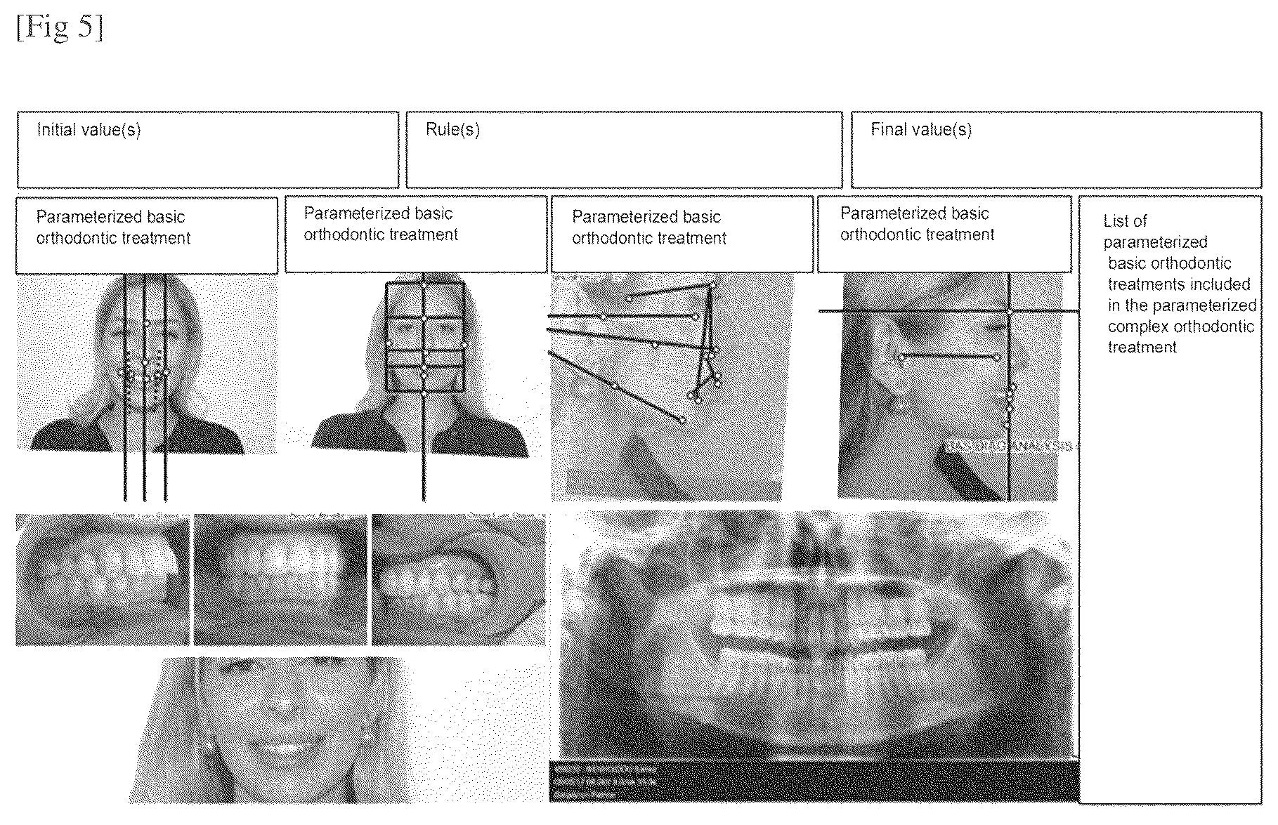 Patent US12564479 Figure 3 – Method for manufacturing an orthodontic appliance