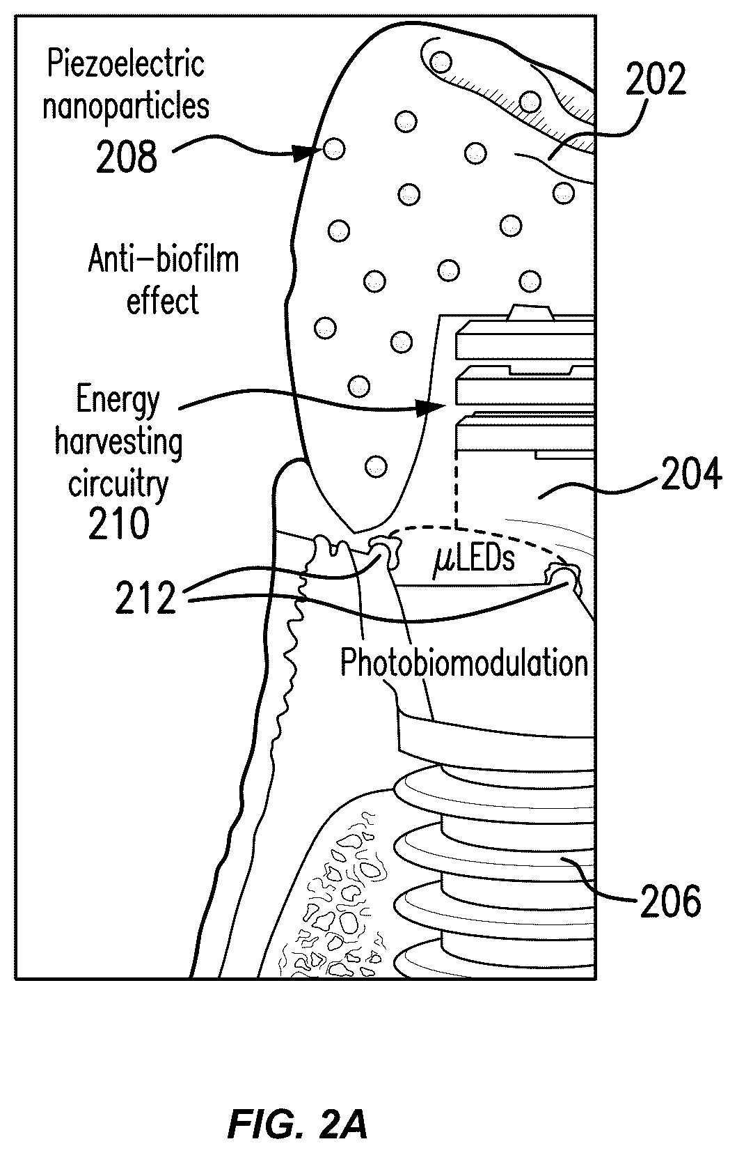 Patent US12564480 Figure 2 – Smart dental implant system for ambulatory dental care