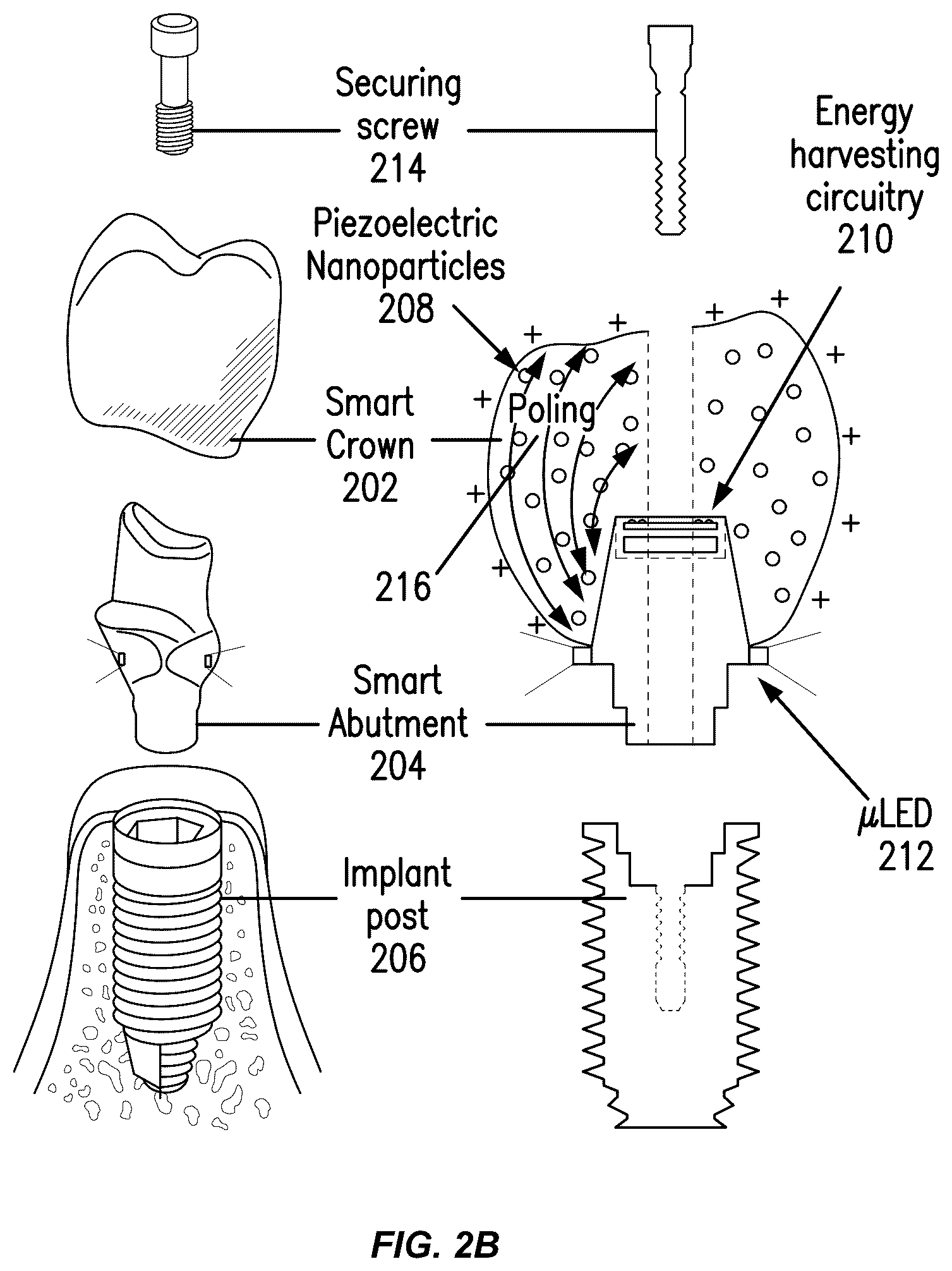Patent US12564480 Figure 3 – Smart dental implant system for ambulatory dental care