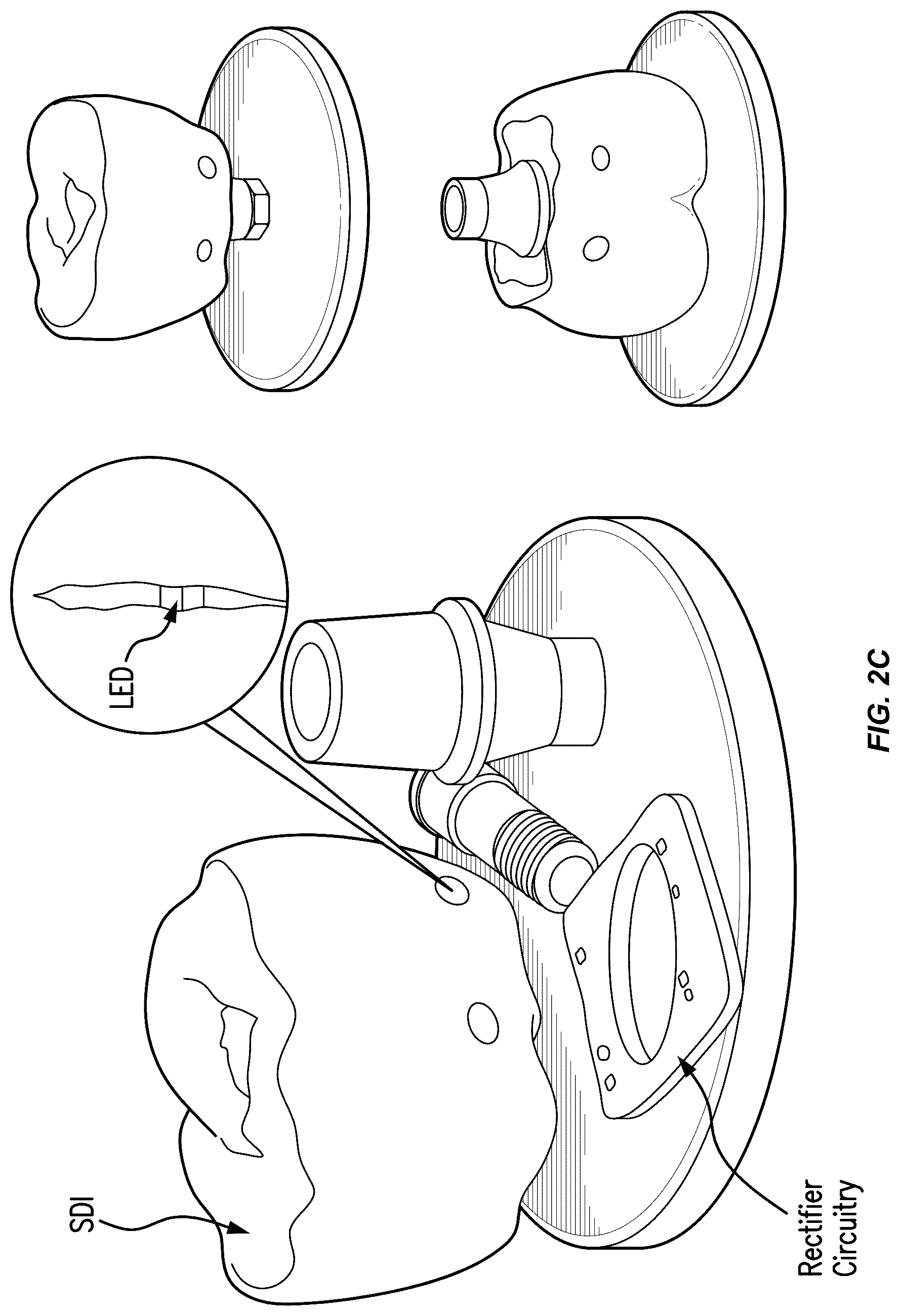 Patent US12564480 Figure 4 – Smart dental implant system for ambulatory dental care