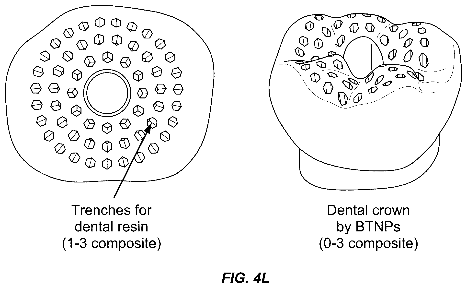 Patent US12564480 Figure 12 – Smart dental implant system for ambulatory dental care