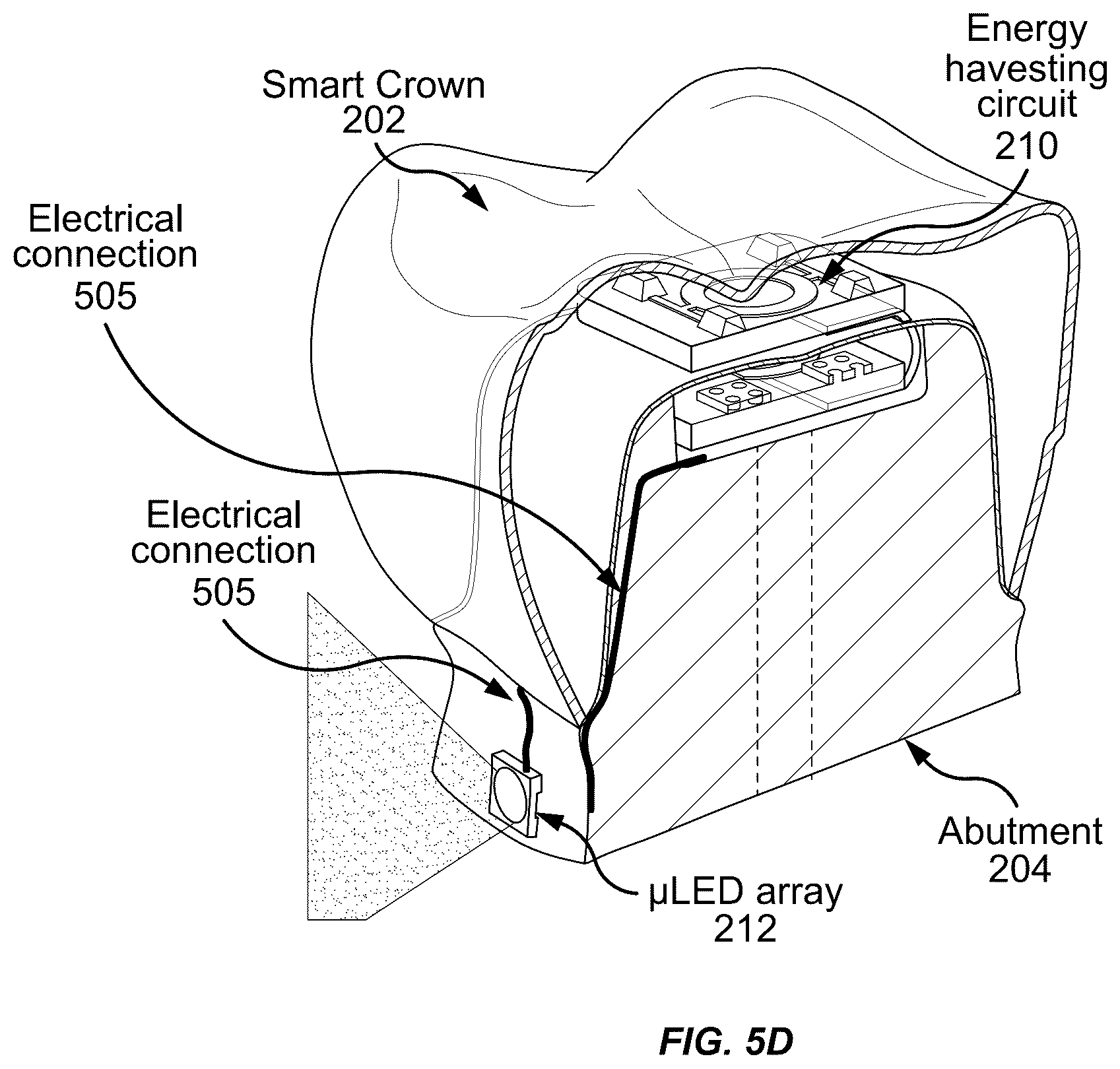 Patent US12564480 Figure 16 – Smart dental implant system for ambulatory dental care