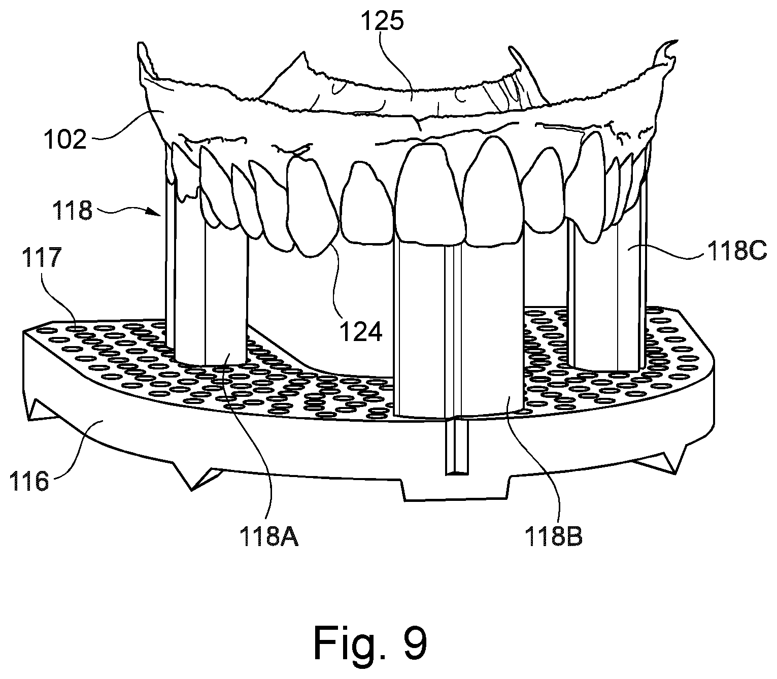 Patent US12564481 Figure 14 – Patient individual physical transfer key