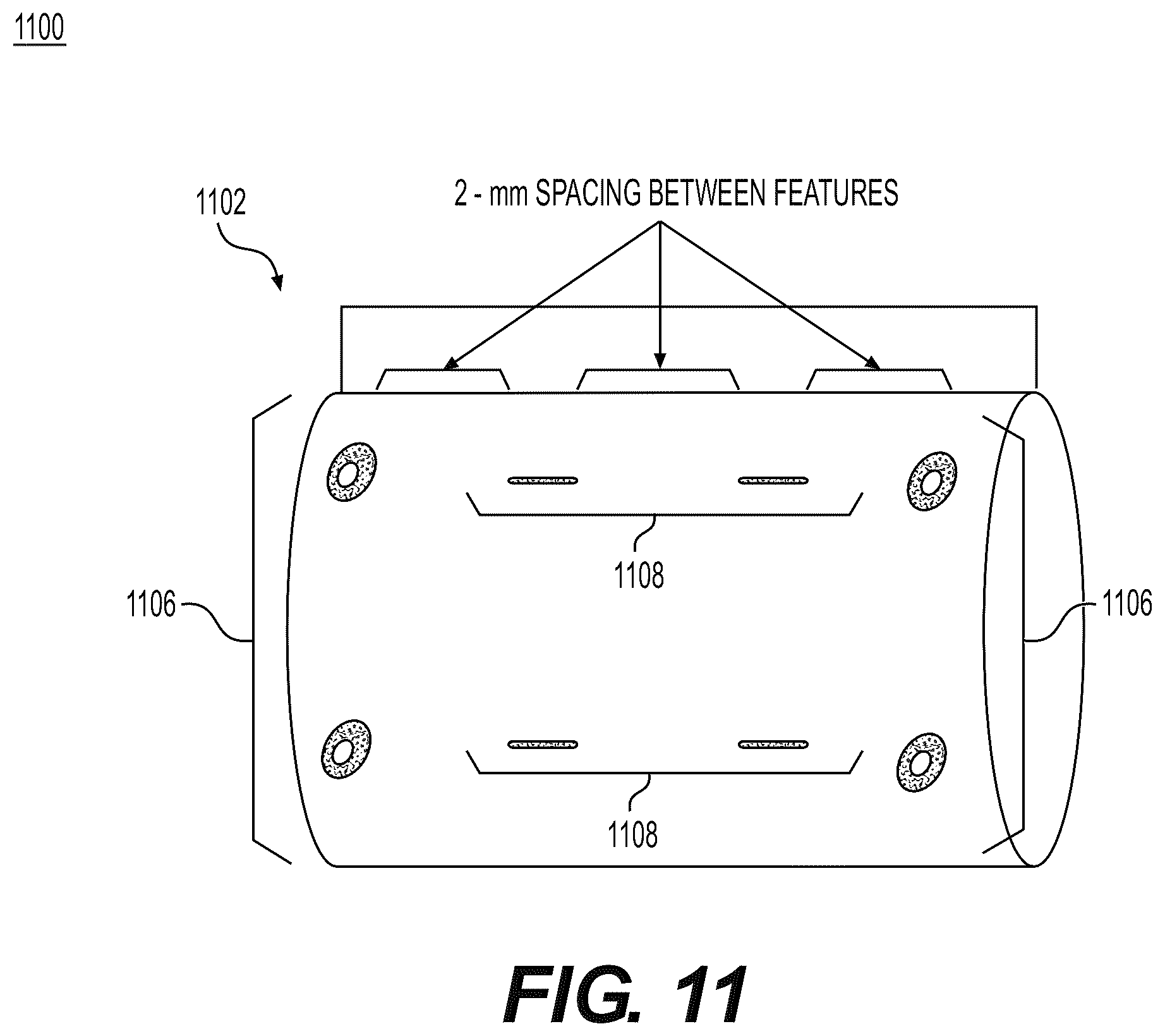 Patent US12564485 Figure 11 – Tissue grafts with pre-made attachment points