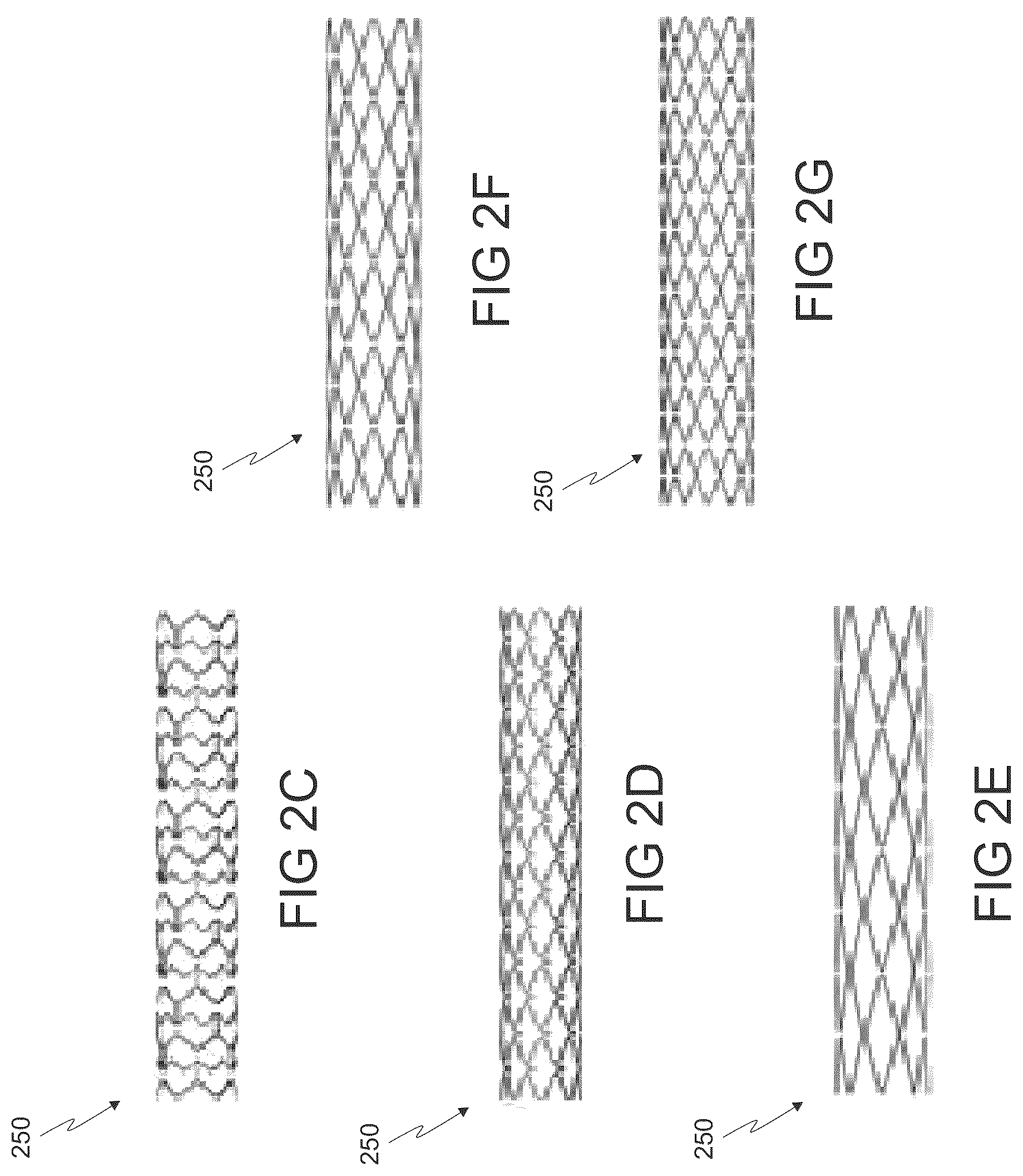 Patent US12564486 Figure 4 – Devices and methods for treating an aneurysm