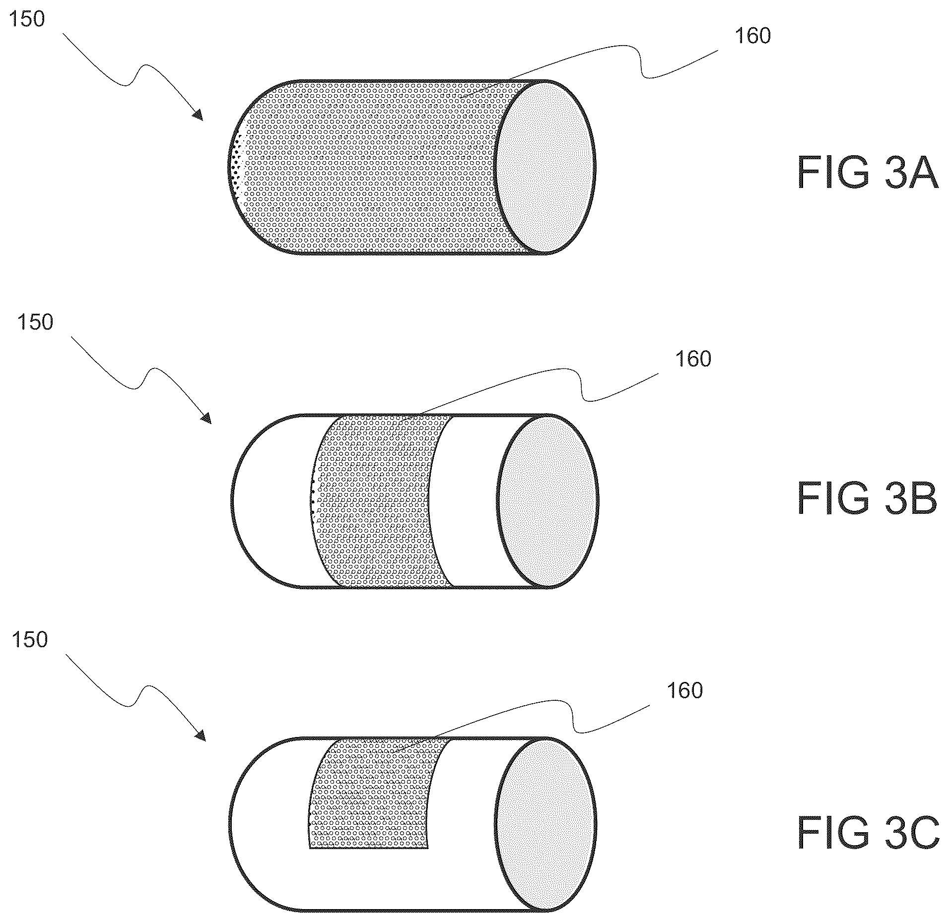 Patent US12564486 Figure 5 – Devices and methods for treating an aneurysm