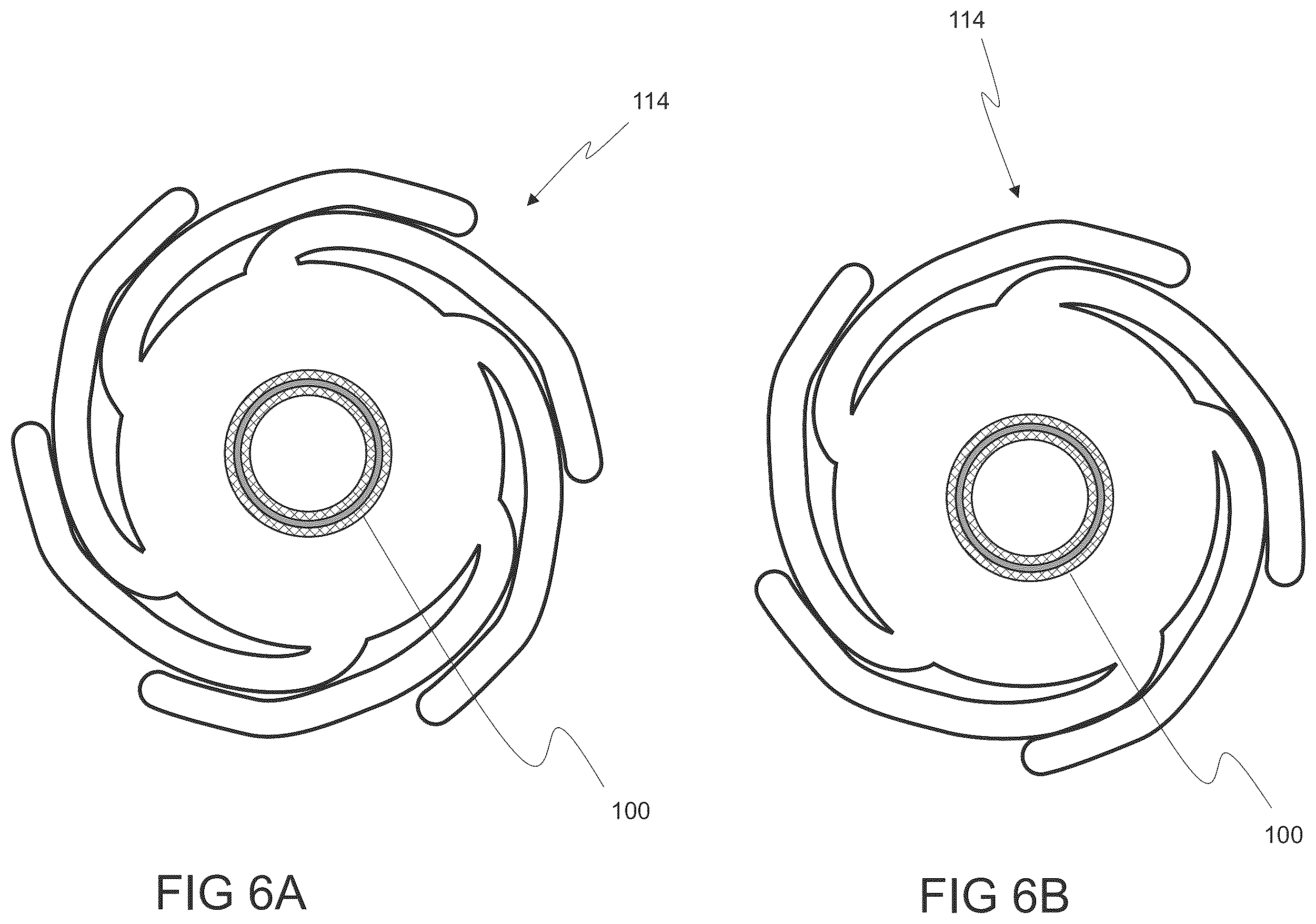 Patent US12564486 Figure 9 – Devices and methods for treating an aneurysm