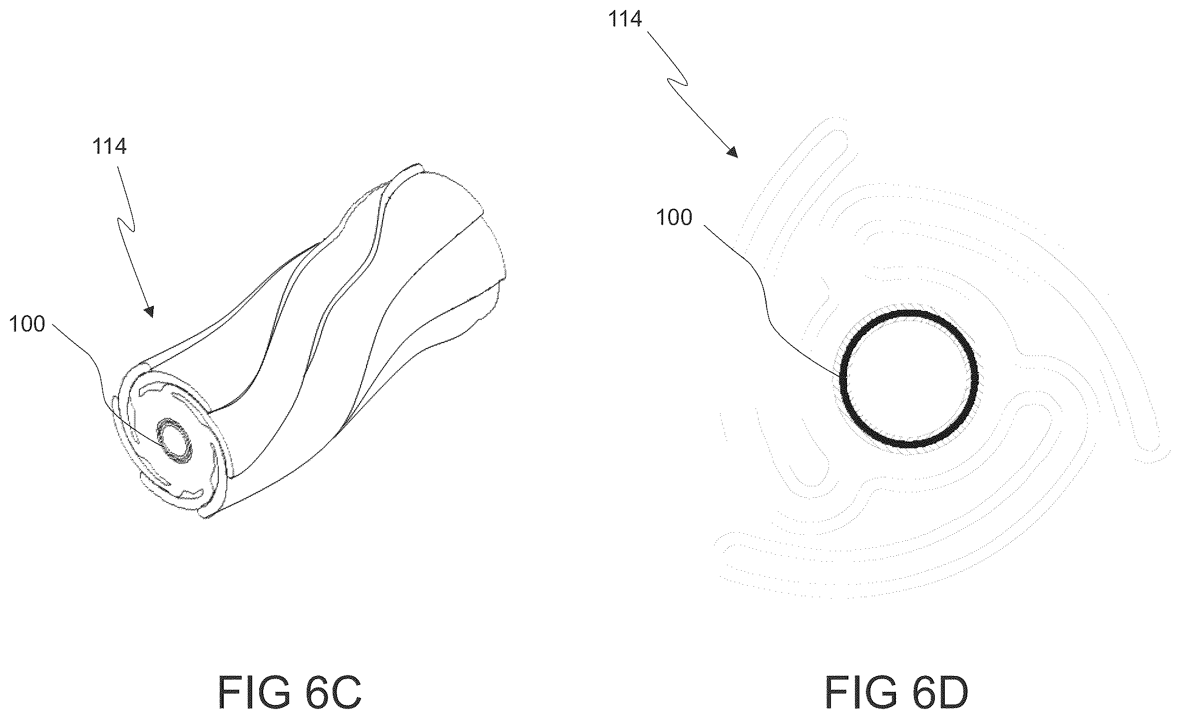 Patent US12564486 Figure 10 – Devices and methods for treating an aneurysm