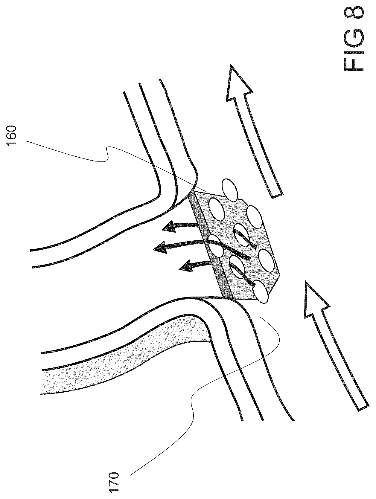 Patent US12564486 Figure 12 – Devices and methods for treating an aneurysm