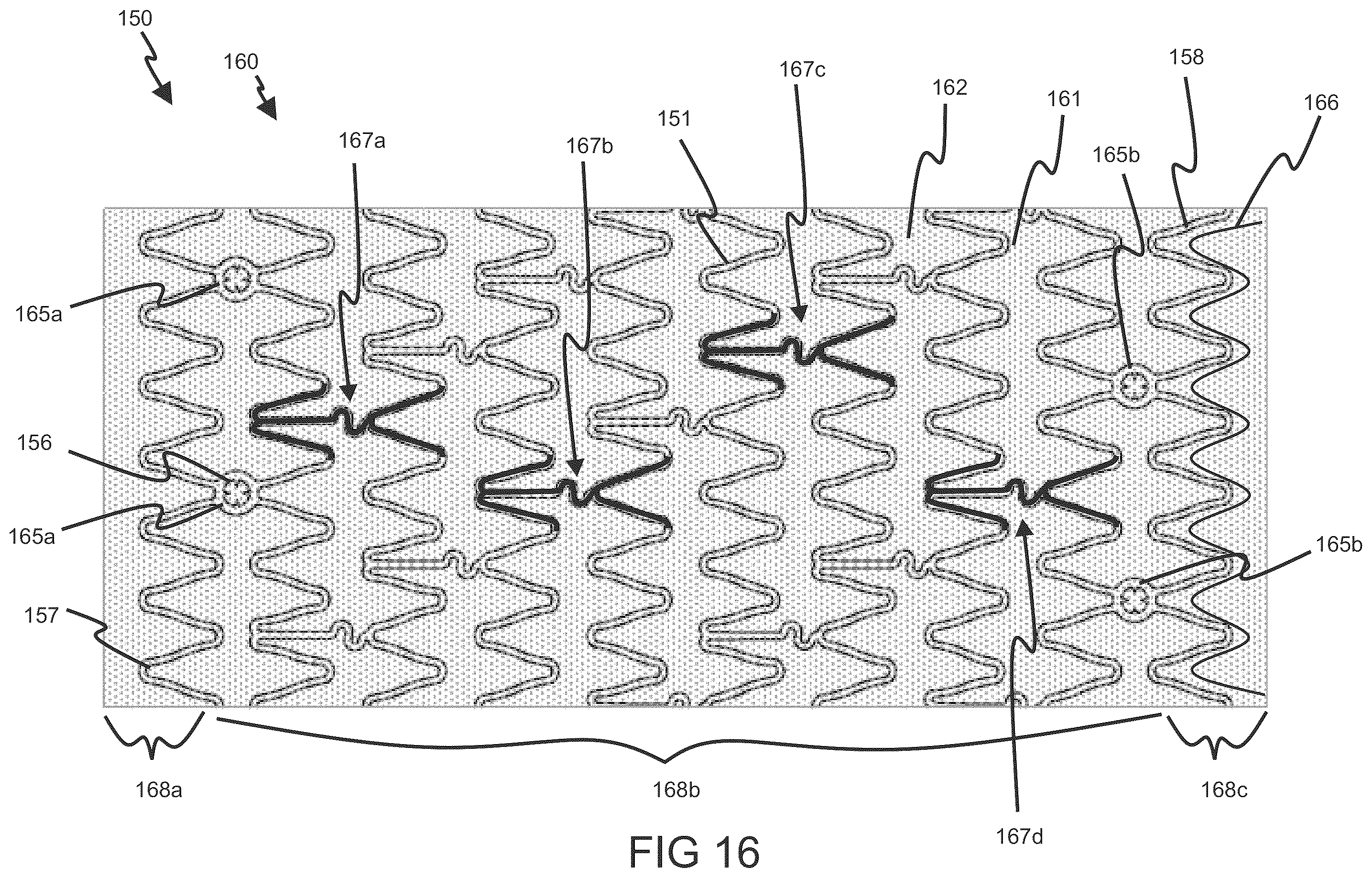 Patent US12564486 Figure 20 – Devices and methods for treating an aneurysm