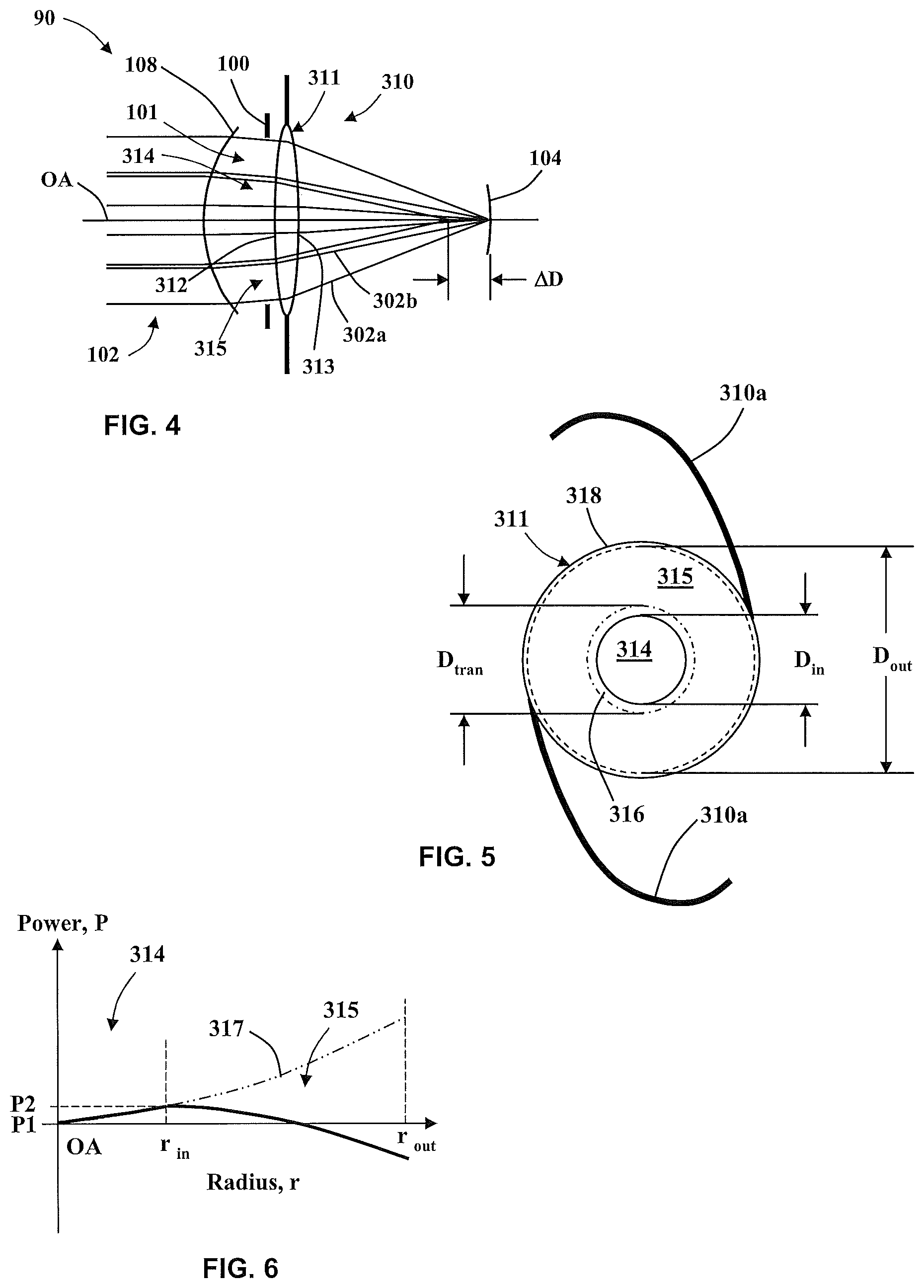 Patent US12564487 Figure 2 – Method of making a multizonal lens with enhanced performance