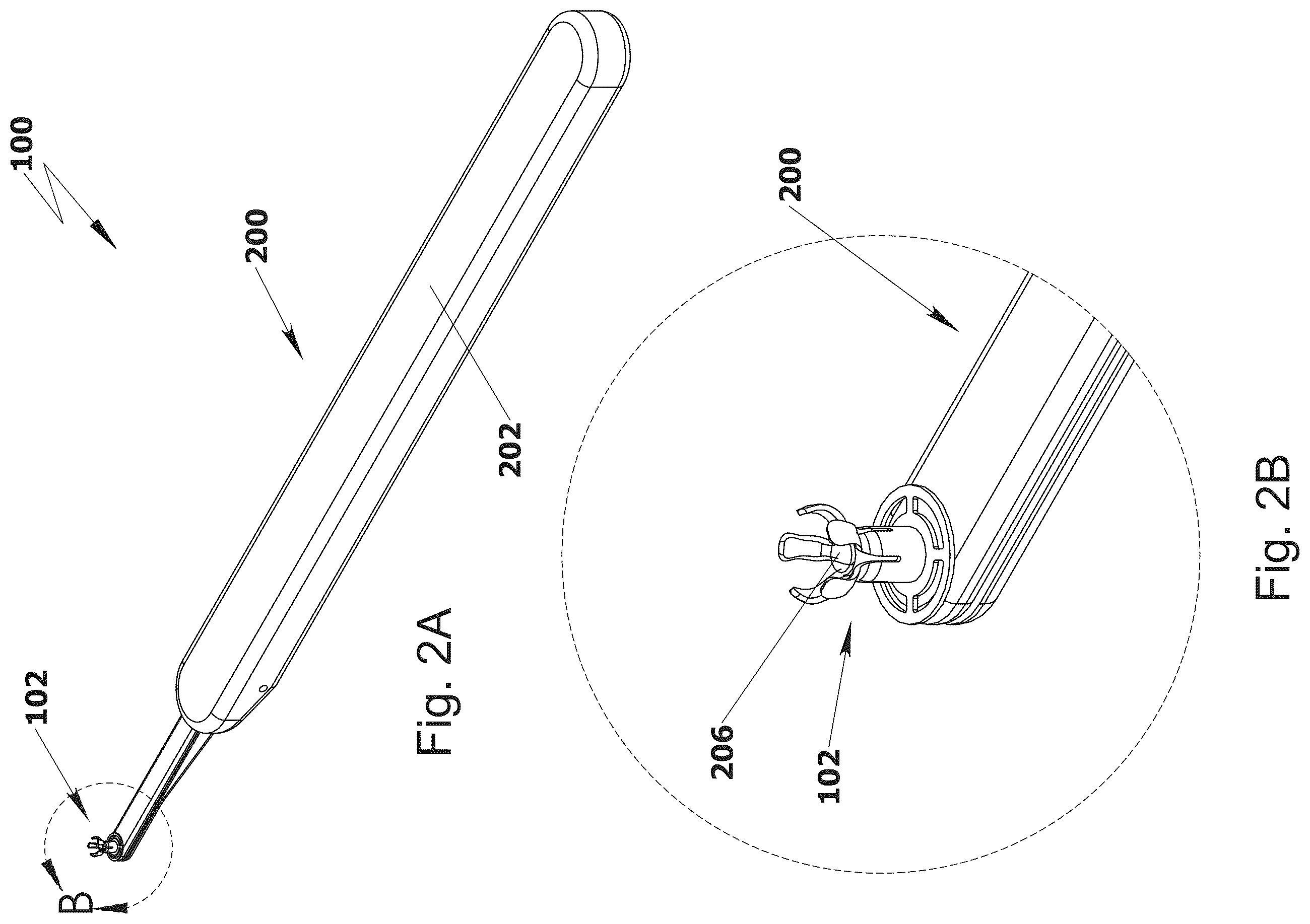 Patent US12564488 Figure 2 – Ossicular replacement prothesis with controllable stapedial conforming function, manufacture method thereof and applicator device therefor