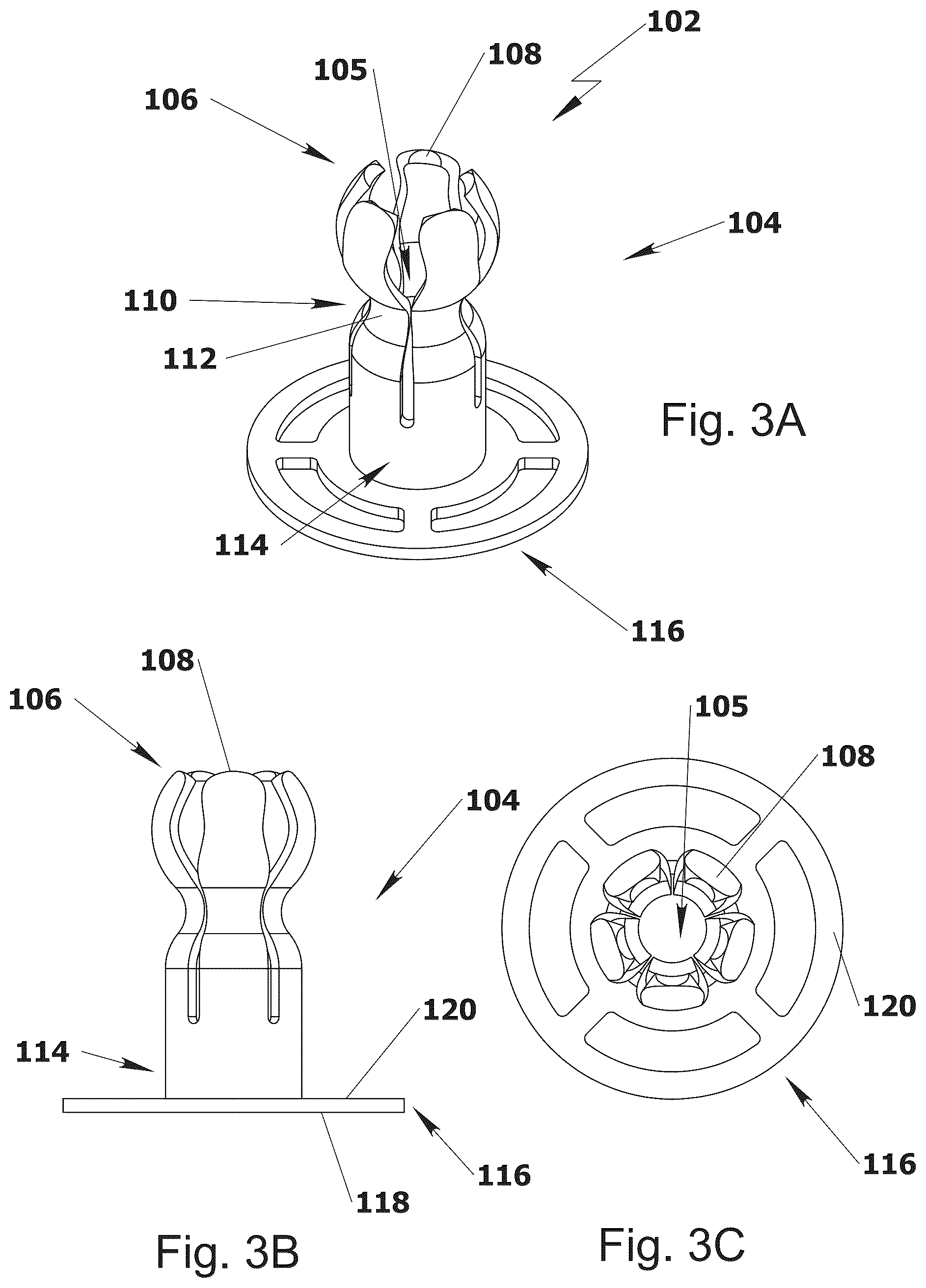 Patent US12564488 Figure 3 – Ossicular replacement prothesis with controllable stapedial conforming function, manufacture method thereof and applicator device therefor