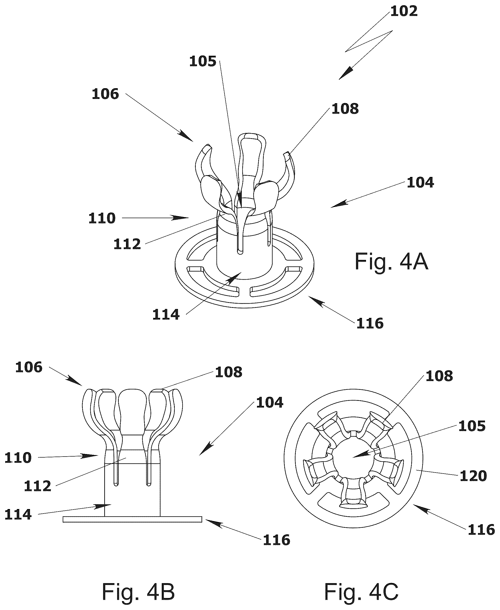 Patent US12564488 Figure 4 – Ossicular replacement prothesis with controllable stapedial conforming function, manufacture method thereof and applicator device therefor