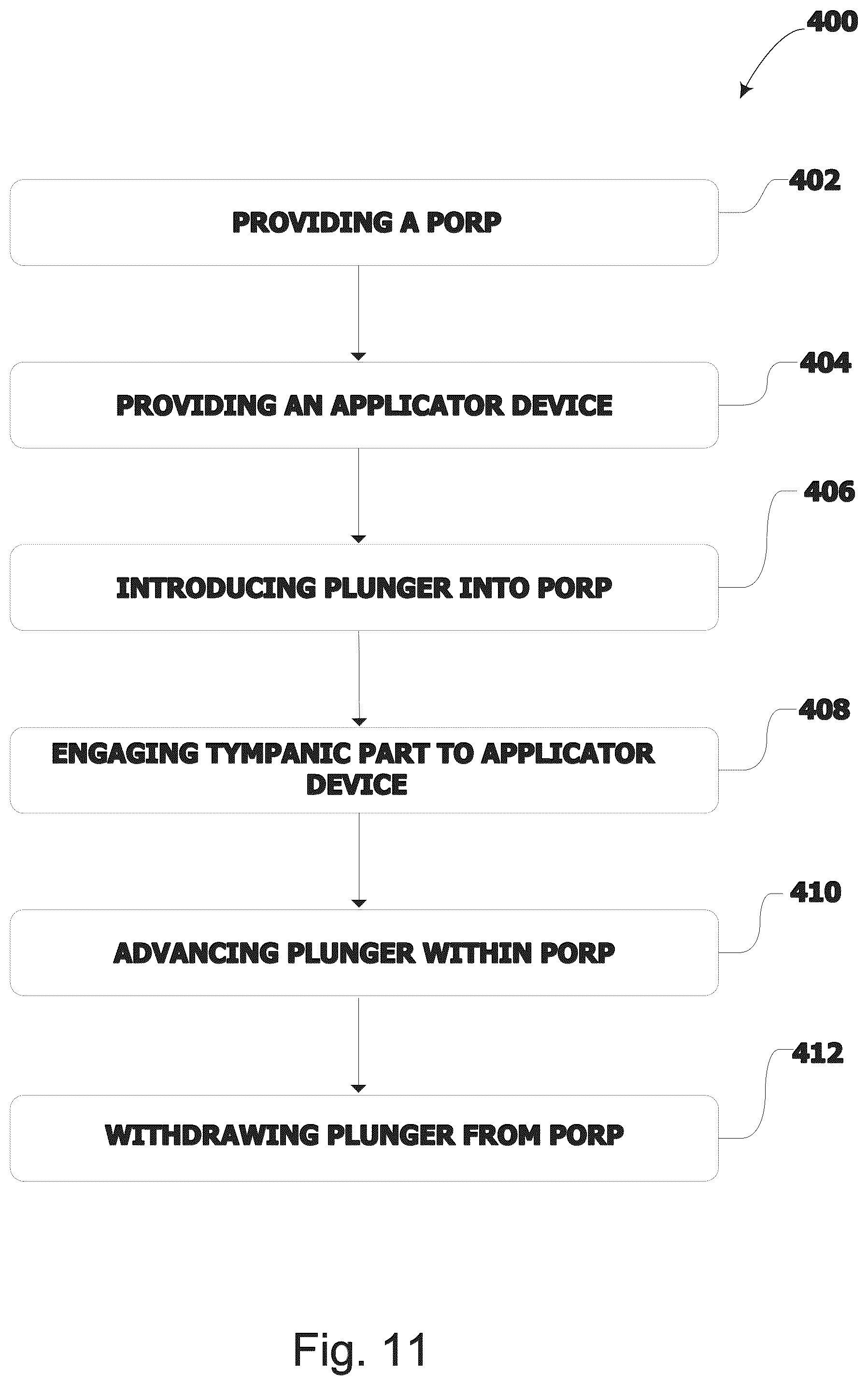 Patent US12564488 Figure 11 – Ossicular replacement prothesis with controllable stapedial conforming function, manufacture method thereof and applicator device therefor