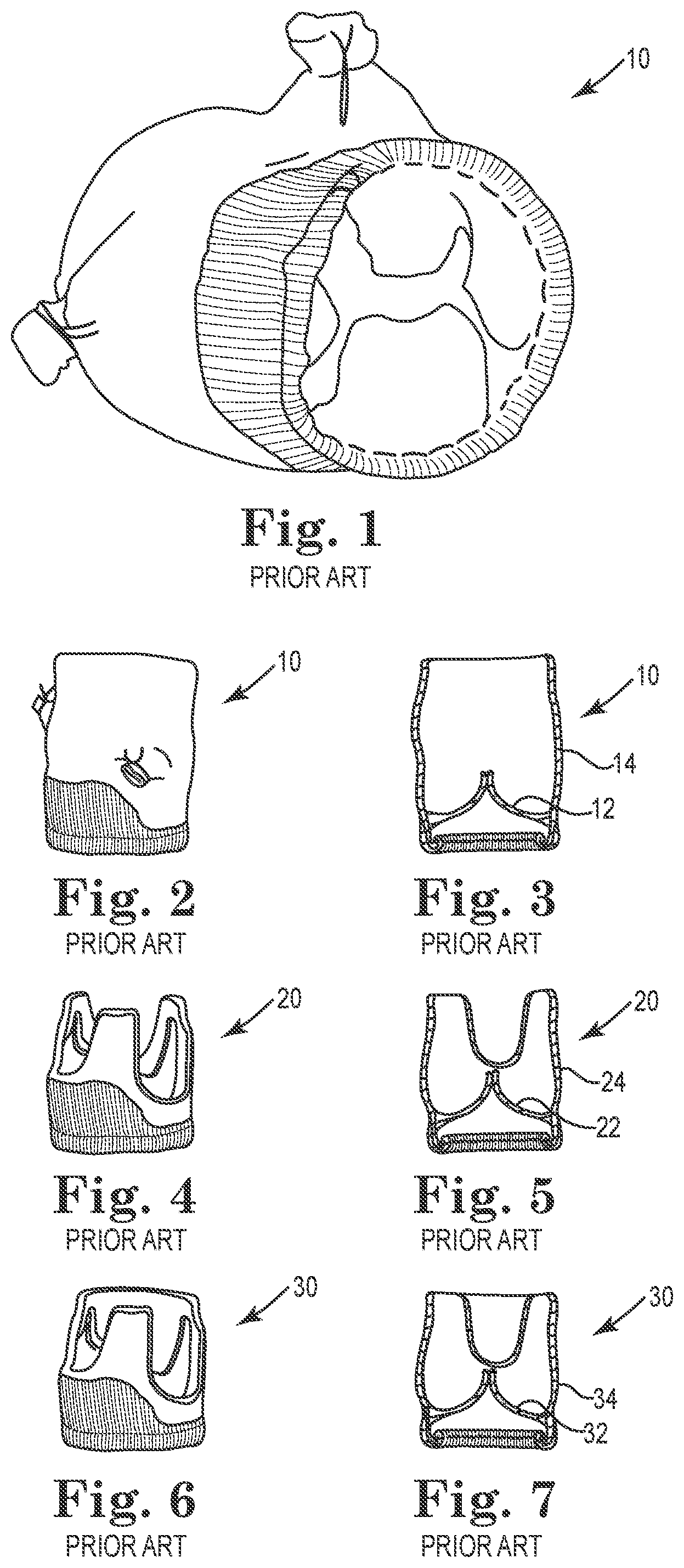 Patent US12564489 Figure 1 – Stented prosthetic heart valves