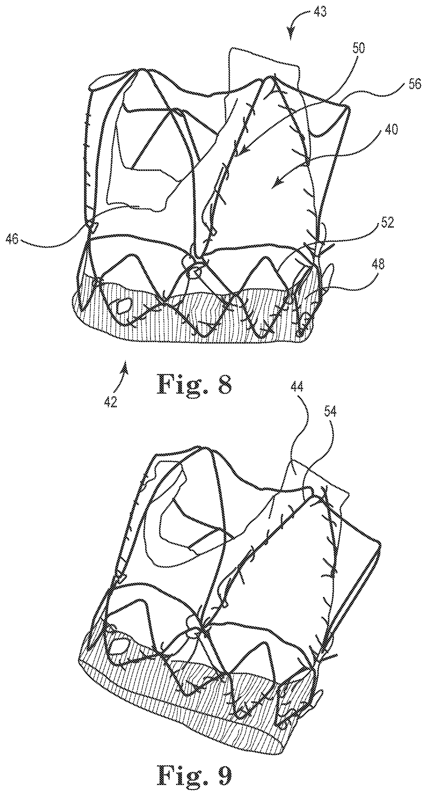 Patent US12564489 Figure 2 – Stented prosthetic heart valves