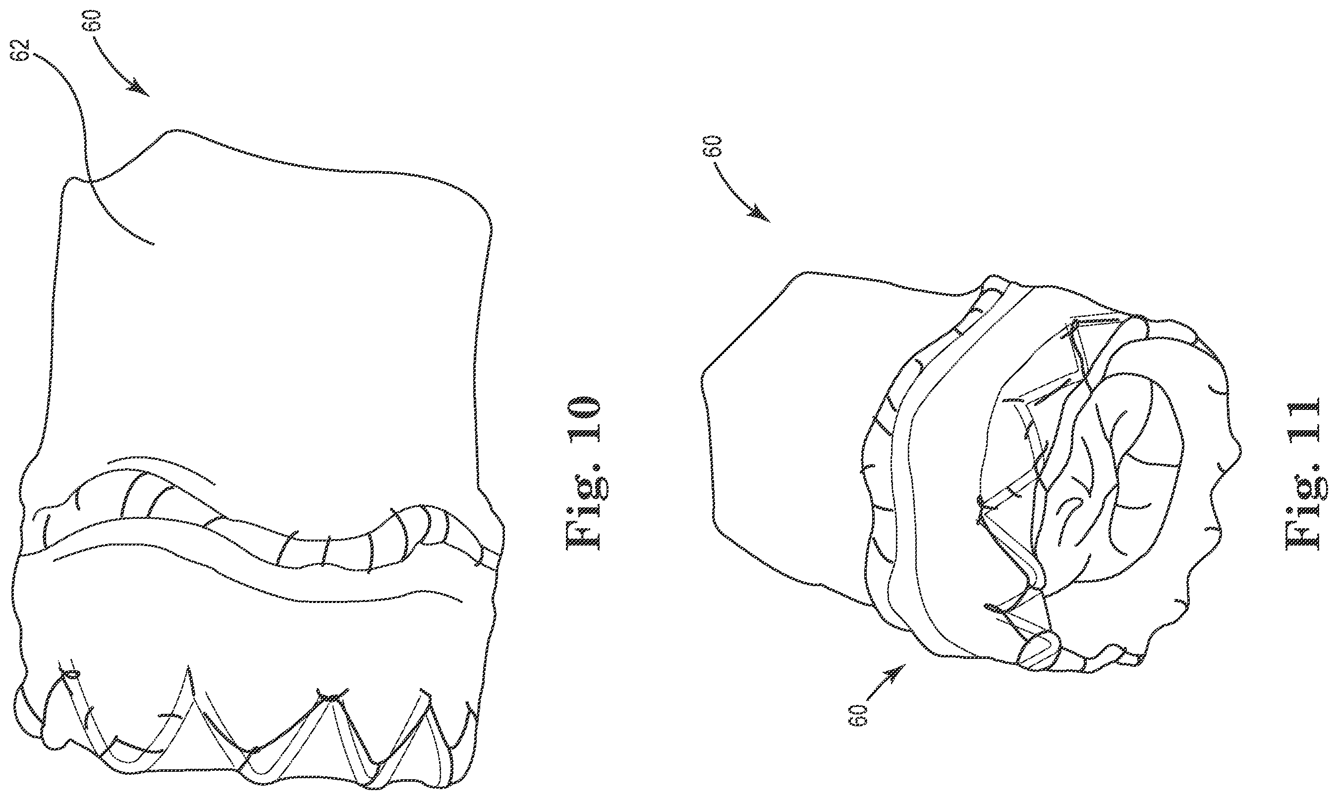 Patent US12564489 Figure 3 – Stented prosthetic heart valves
