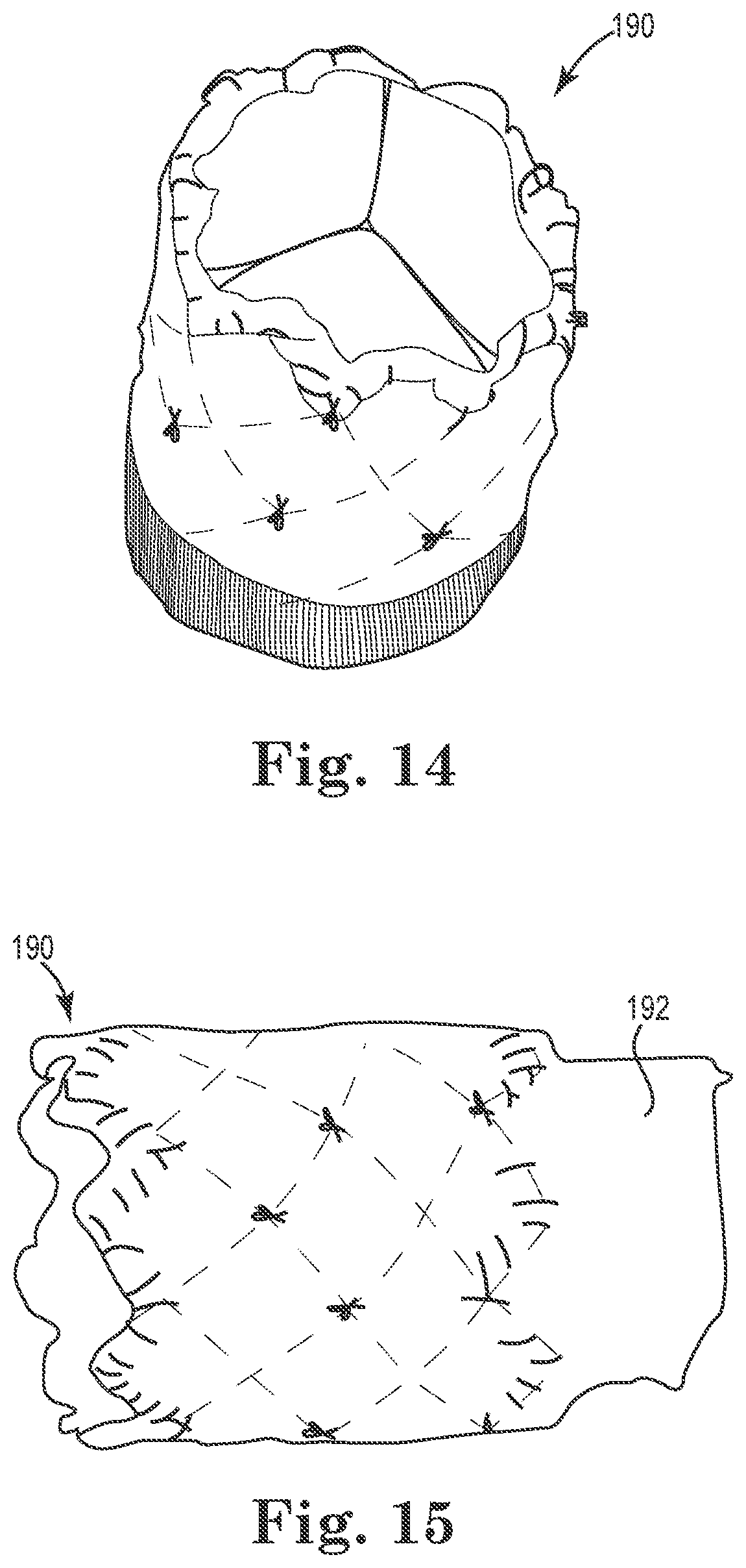 Patent US12564489 Figure 5 – Stented prosthetic heart valves