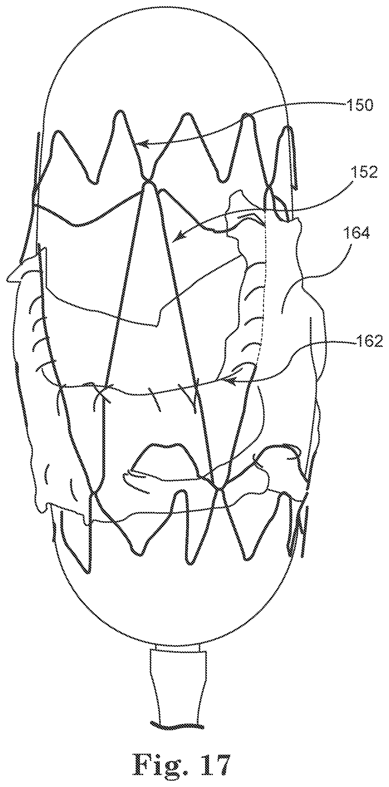 Patent US12564489 Figure 7 – Stented prosthetic heart valves