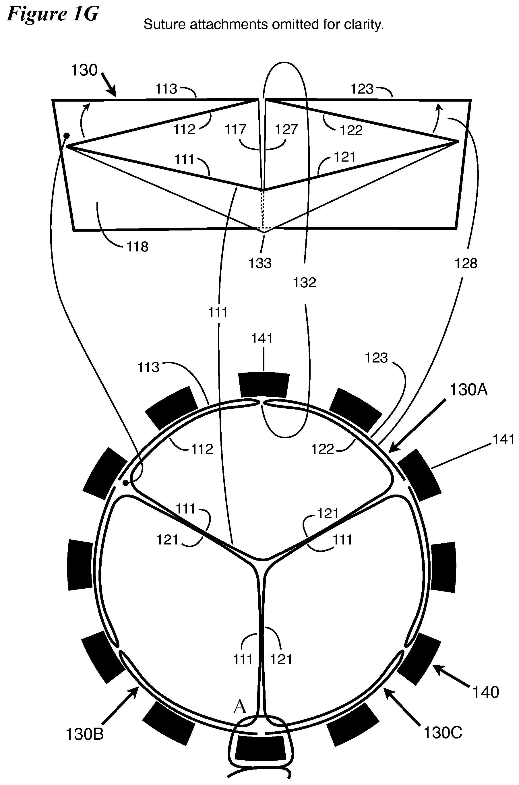 Patent US12564490 Figure 5 – Percutaneously deliverable heart valve