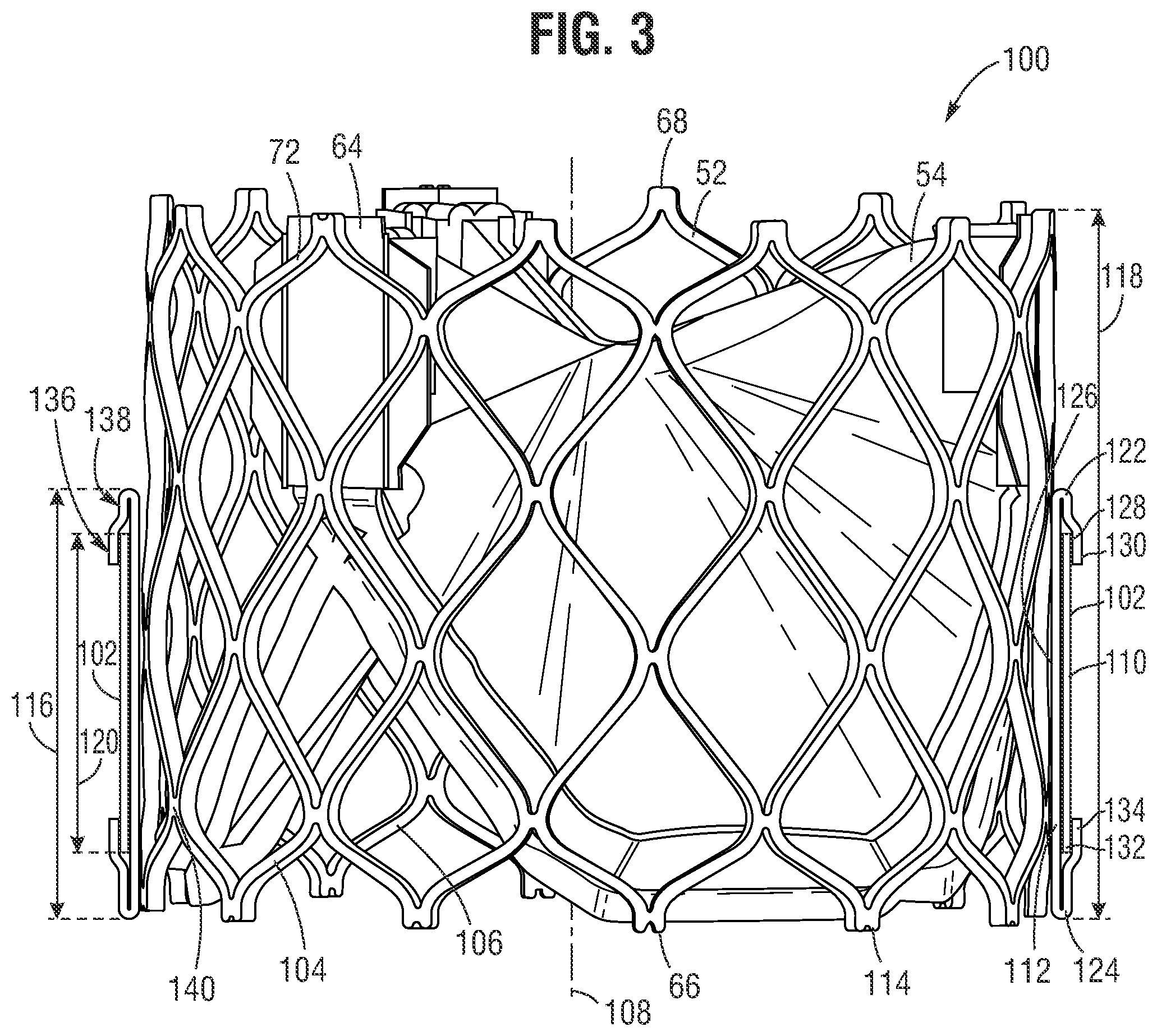 Patent US12564491 Figure 2 – Multi-layer covering for a prosthetic heart valve