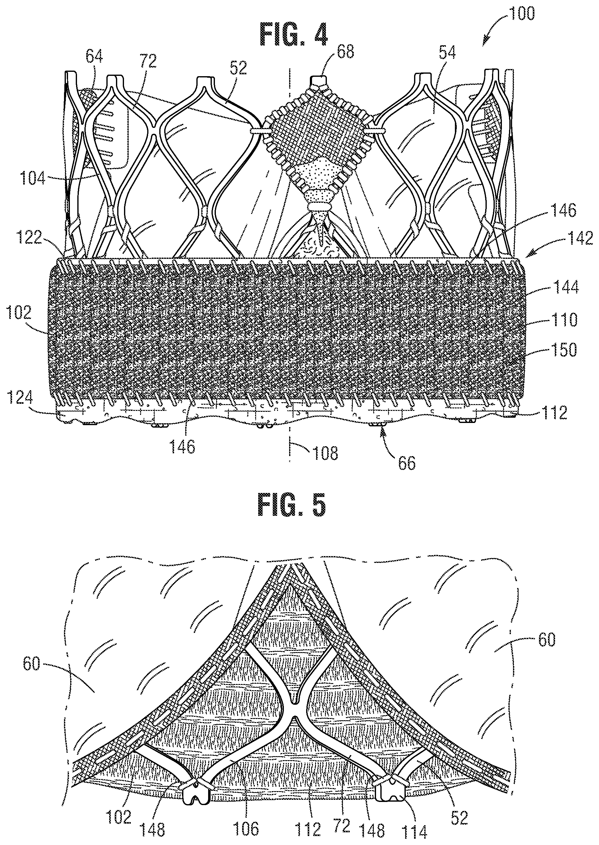 Patent US12564491 Figure 3 – Multi-layer covering for a prosthetic heart valve