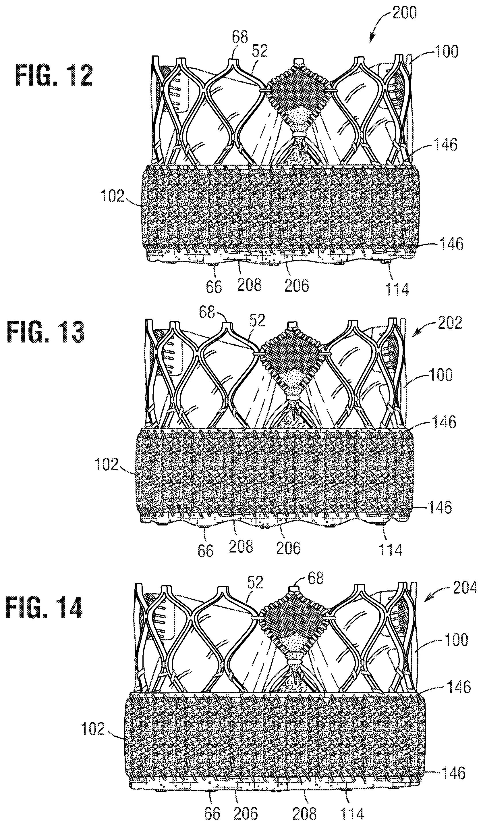 Patent US12564491 Figure 8 – Multi-layer covering for a prosthetic heart valve