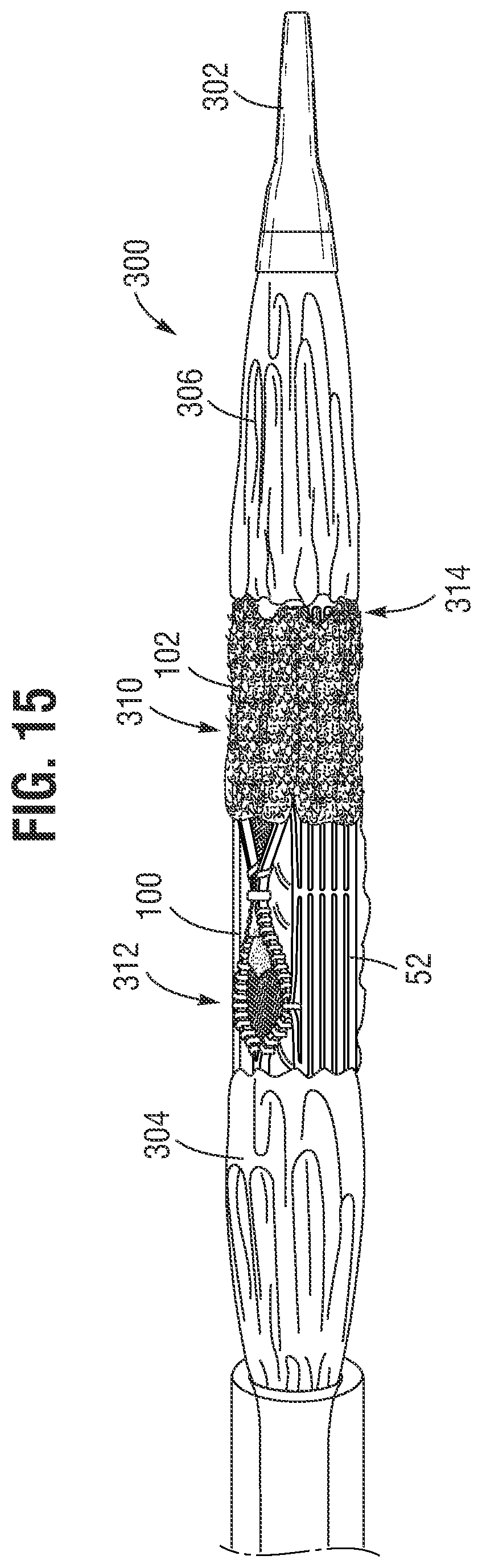 Patent US12564491 Figure 9 – Multi-layer covering for a prosthetic heart valve