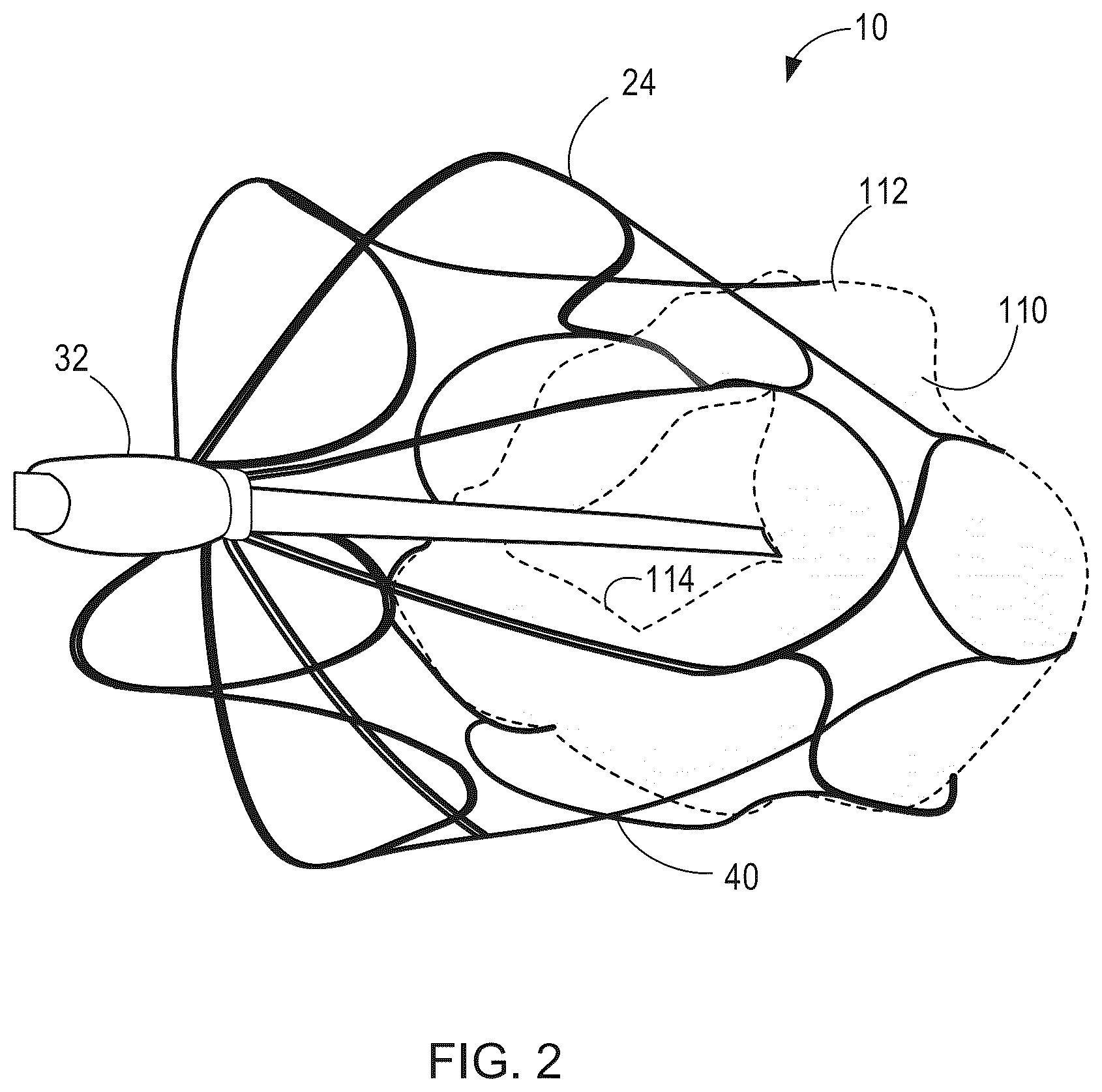 Patent US12564492 Figure 3 – Retrievable self-expanding non-thrombogenic low-profile percutaneous atrioventricular valve prosthesis