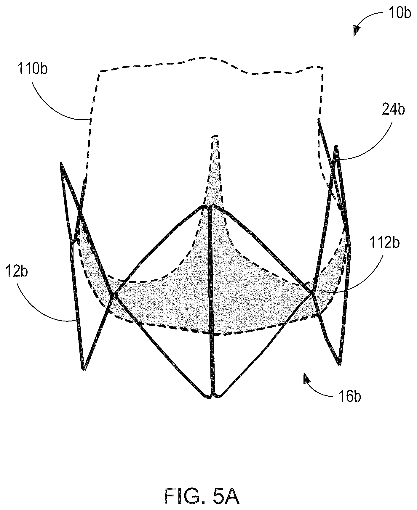 Patent US12564492 Figure 6 – Retrievable self-expanding non-thrombogenic low-profile percutaneous atrioventricular valve prosthesis