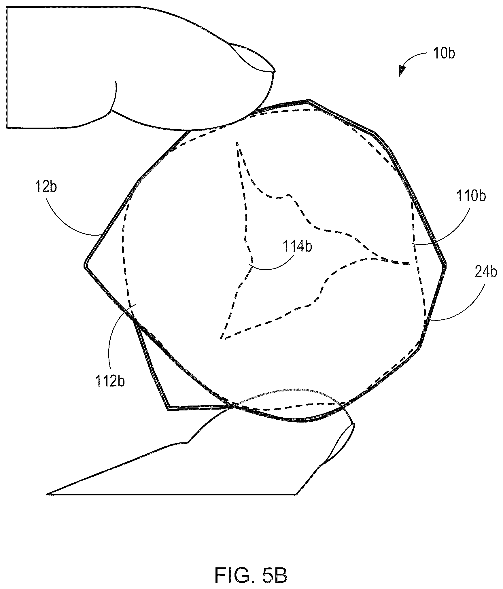 Patent US12564492 Figure 7 – Retrievable self-expanding non-thrombogenic low-profile percutaneous atrioventricular valve prosthesis