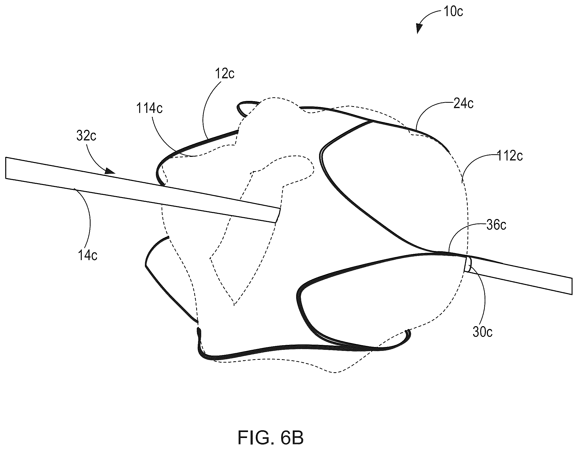 Patent US12564492 Figure 9 – Retrievable self-expanding non-thrombogenic low-profile percutaneous atrioventricular valve prosthesis