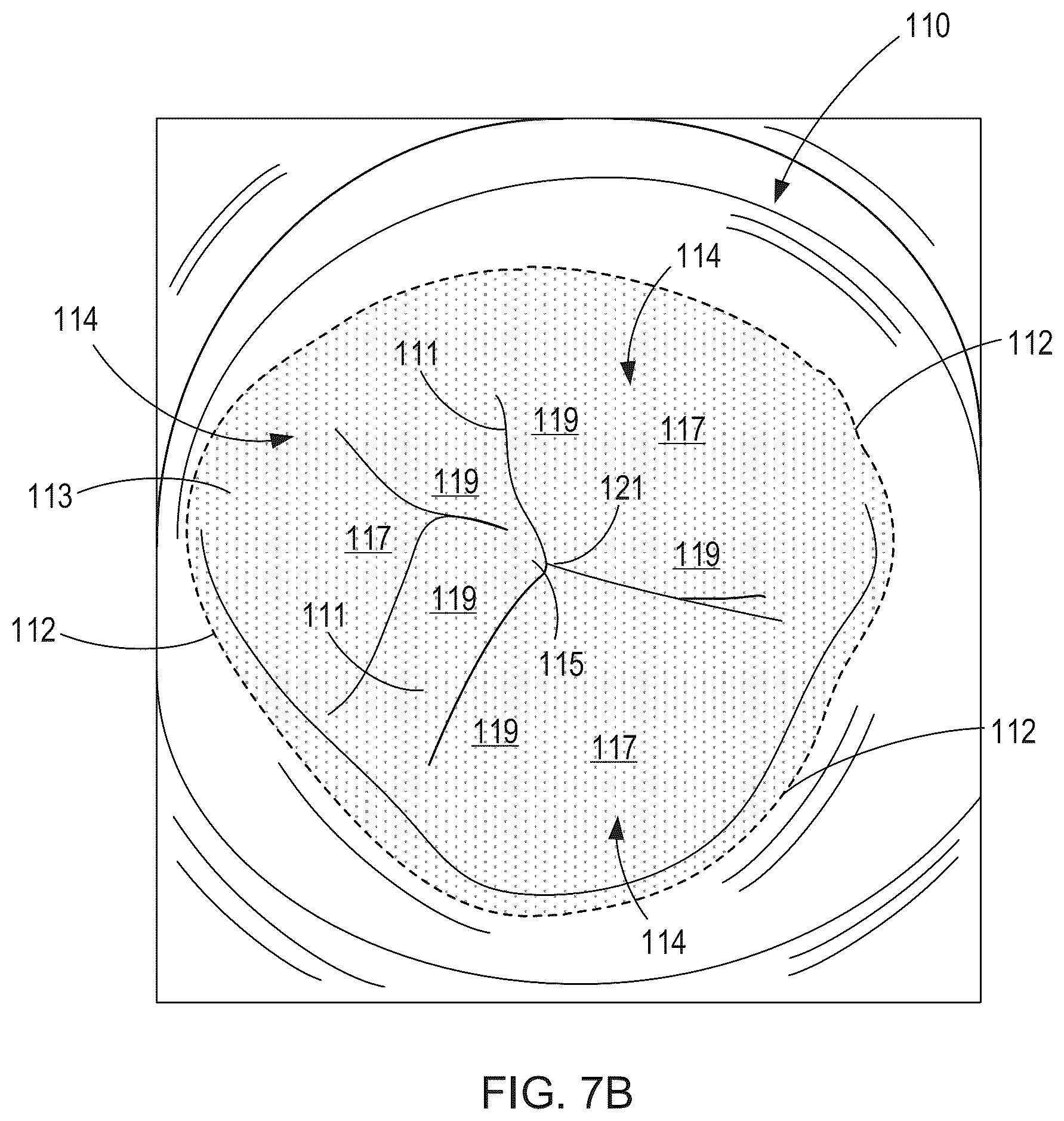 Patent US12564492 Figure 11 – Retrievable self-expanding non-thrombogenic low-profile percutaneous atrioventricular valve prosthesis