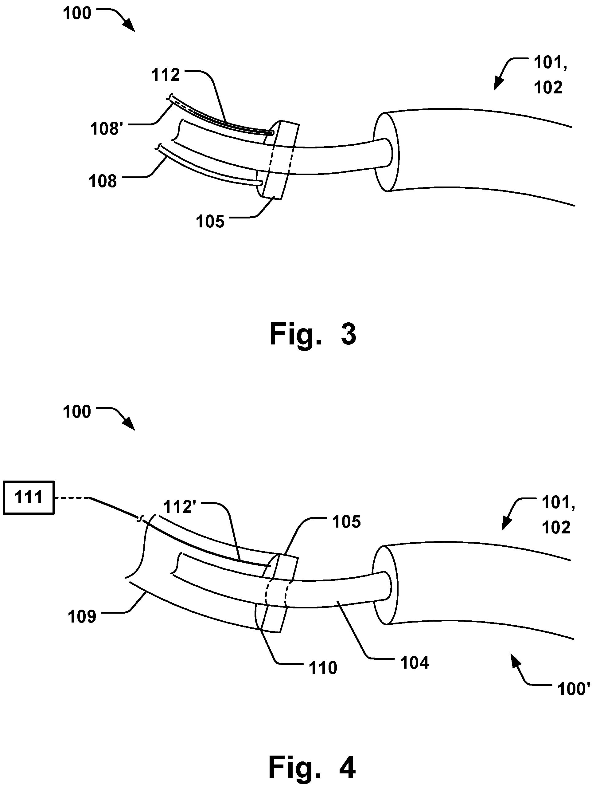 Patent US12564493 Figure 2 – Annuloplasty system