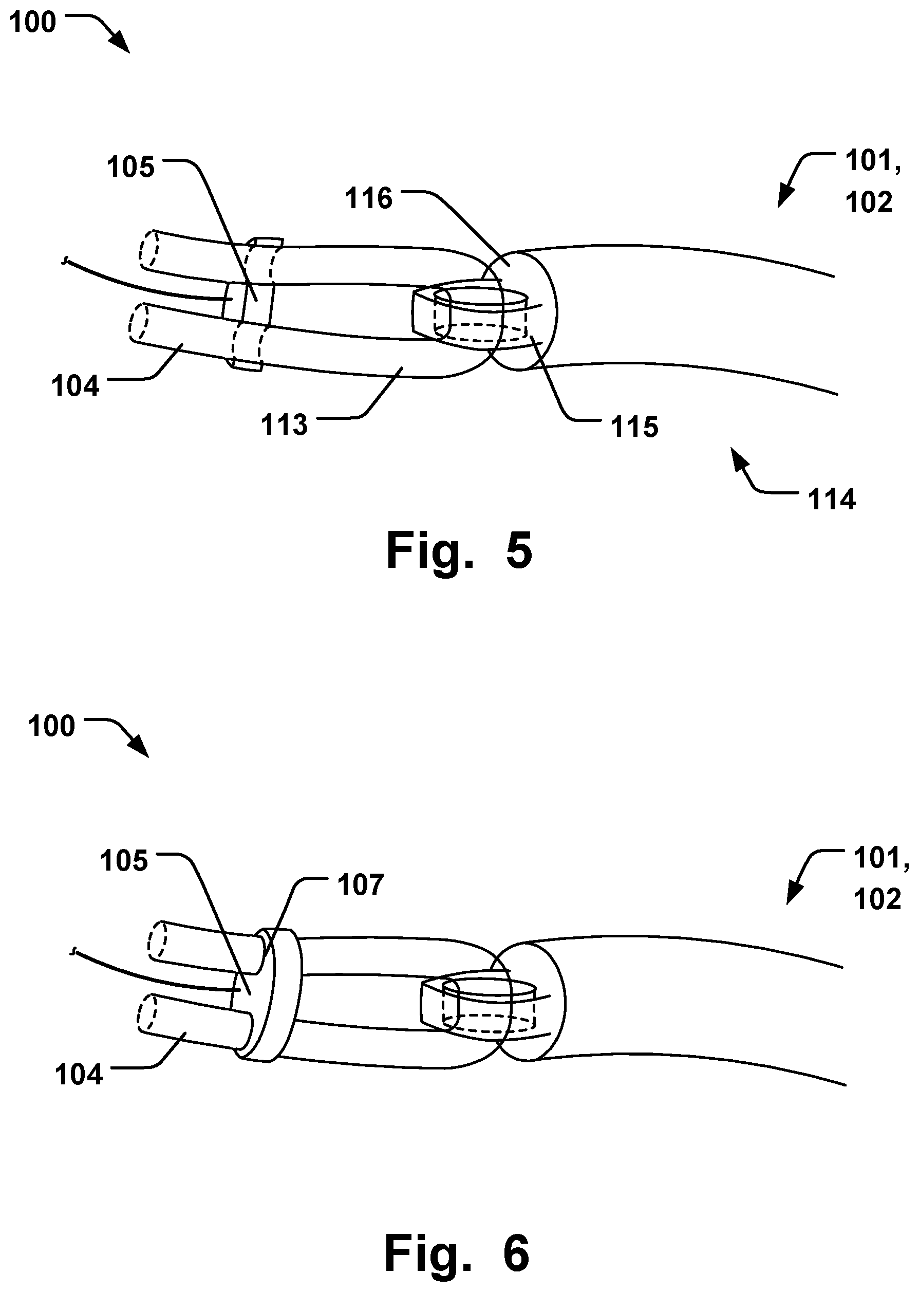 Patent US12564493 Figure 3 – Annuloplasty system