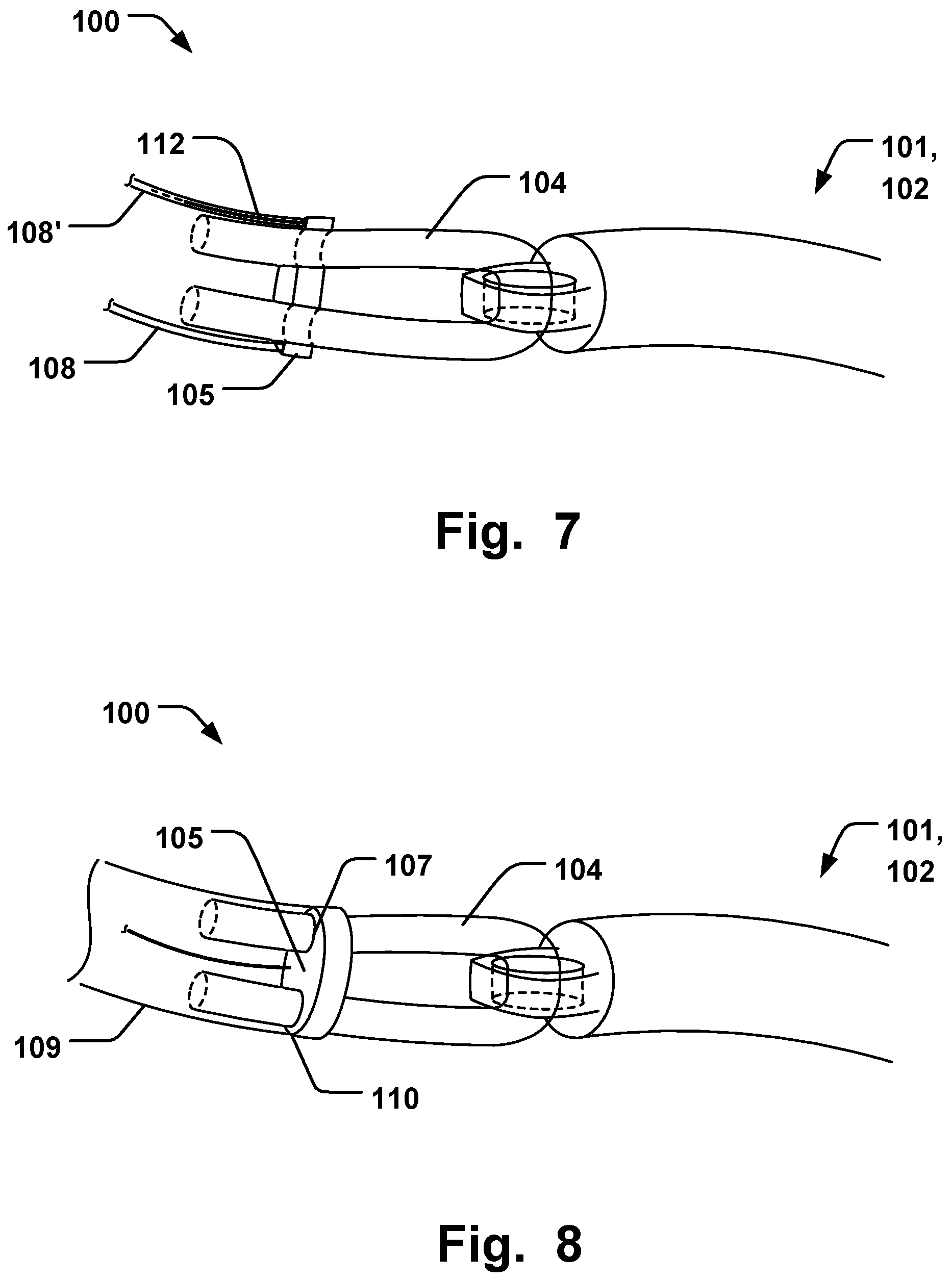 Patent US12564493 Figure 4 – Annuloplasty system